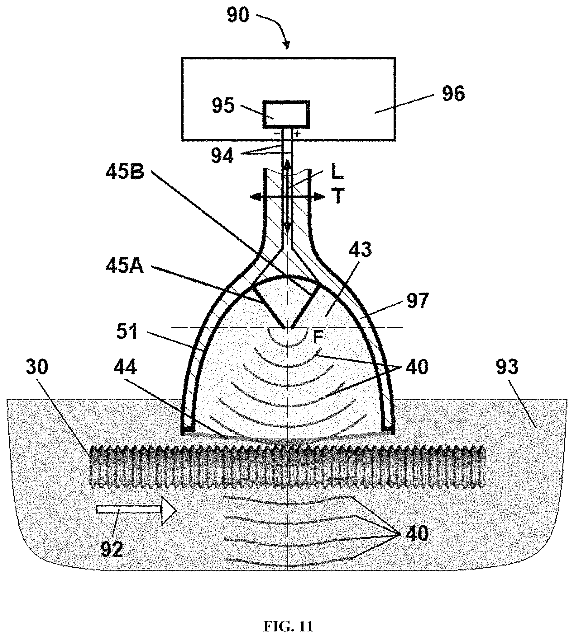 Patent US11771781 Figure 11 – Reprocessing of contaminated reusable devices with direct contact of pressure waves