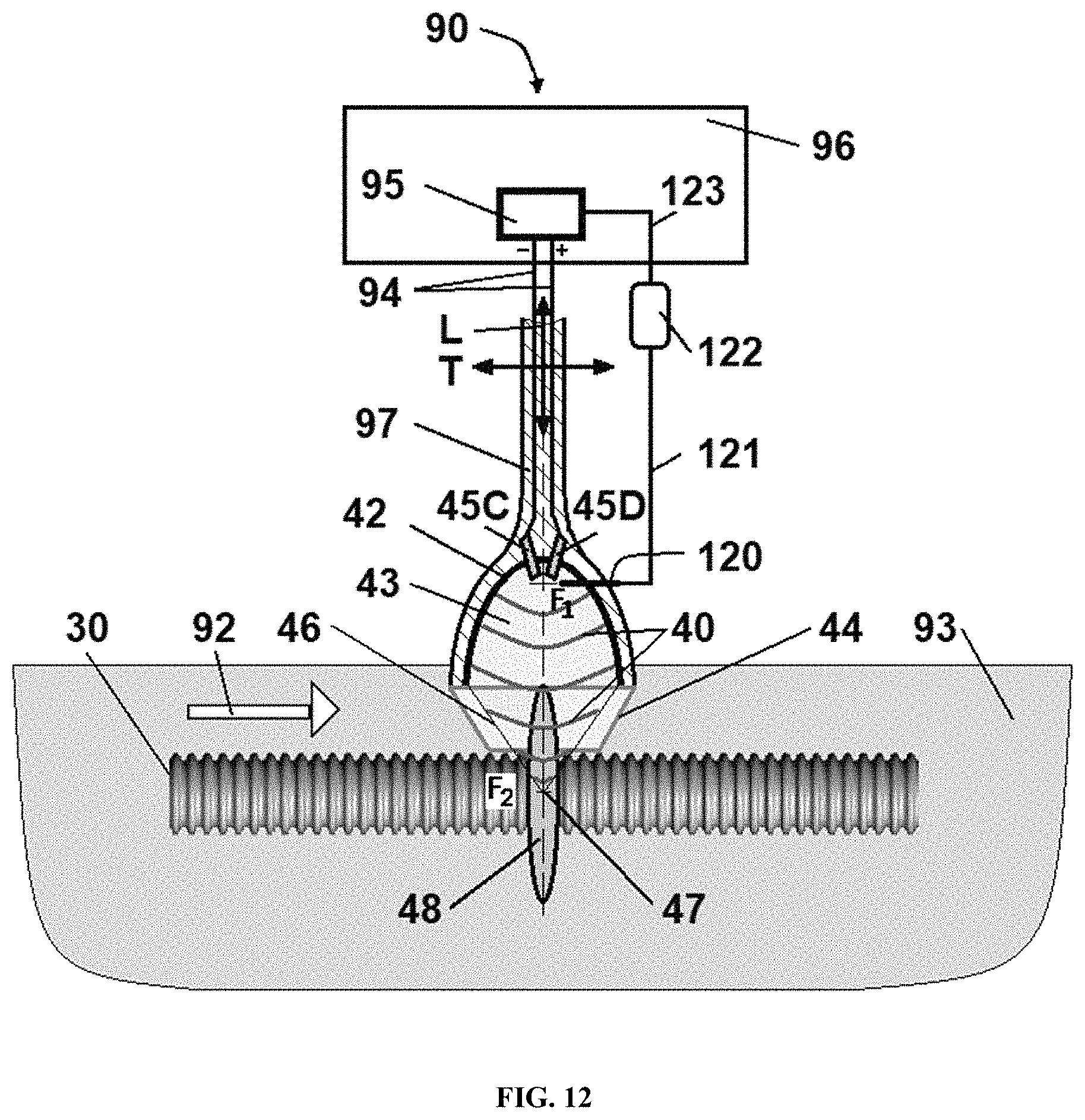 Patent US11771781 Figure 12 – Reprocessing of contaminated reusable devices with direct contact of pressure waves
