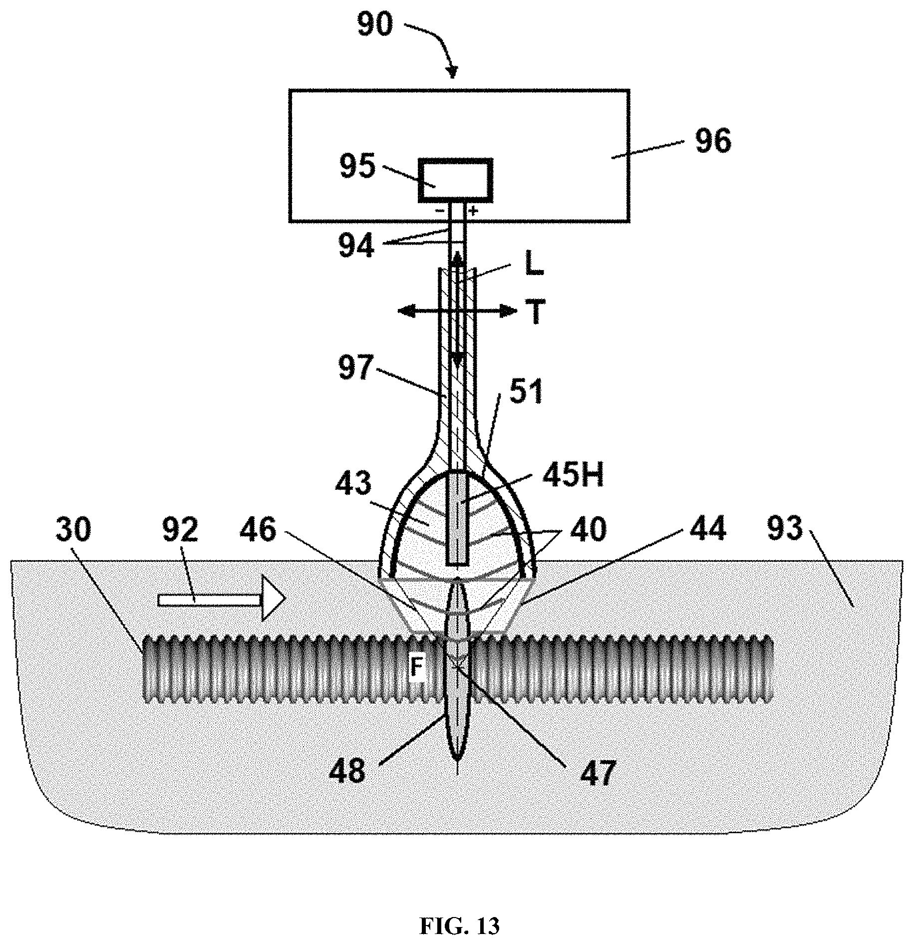 Patent US11771781 Figure 13 – Reprocessing of contaminated reusable devices with direct contact of pressure waves