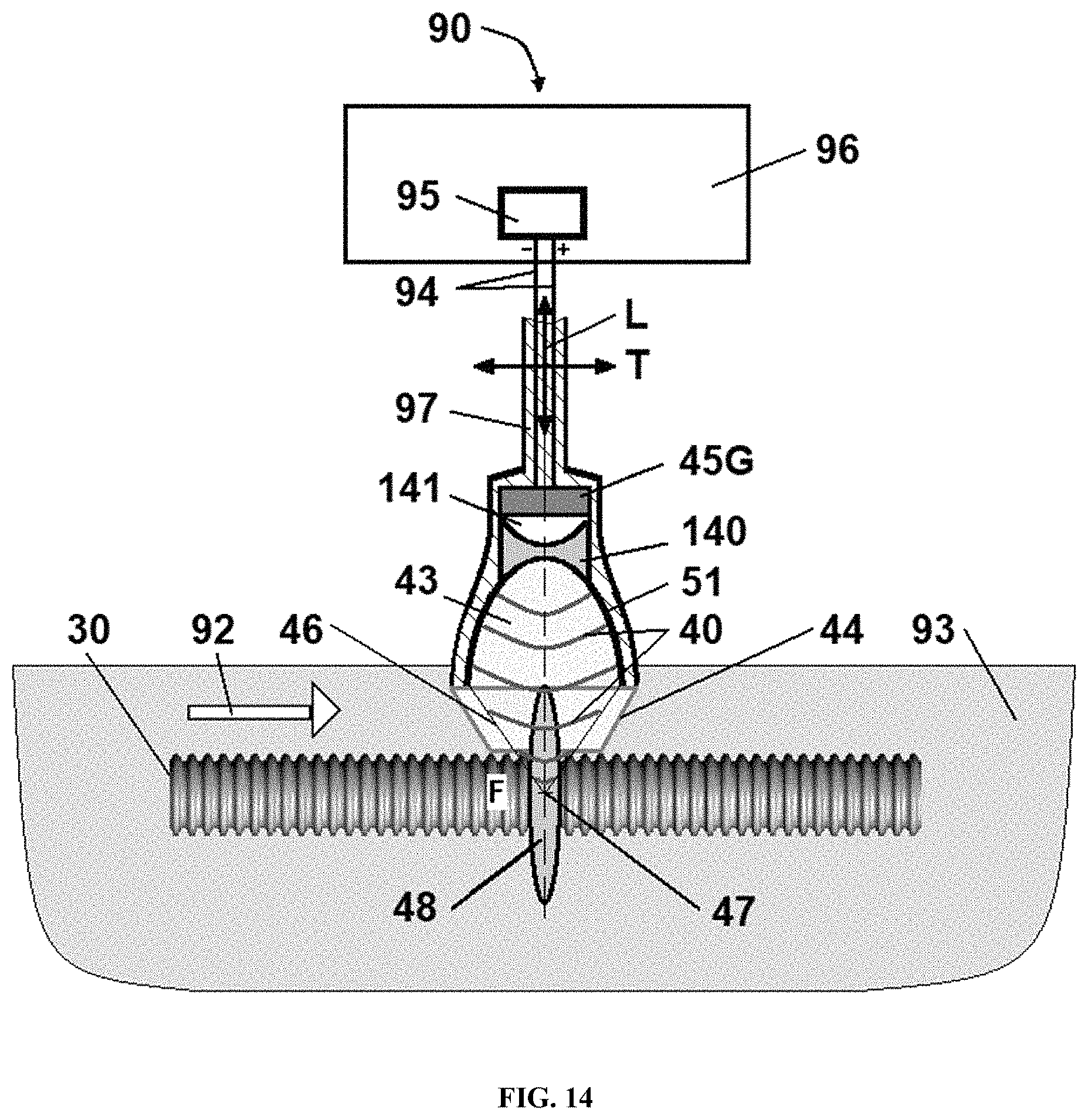 Patent US11771781 Figure 14 – Reprocessing of contaminated reusable devices with direct contact of pressure waves
