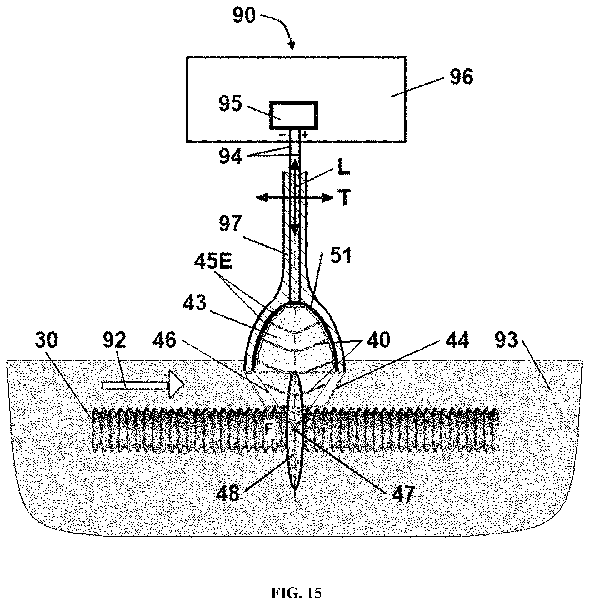 Patent US11771781 Figure 15 – Reprocessing of contaminated reusable devices with direct contact of pressure waves