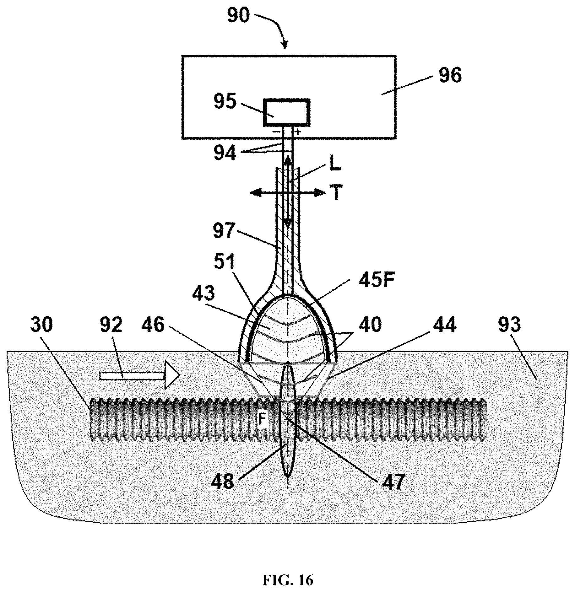 Patent US11771781 Figure 16 – Reprocessing of contaminated reusable devices with direct contact of pressure waves