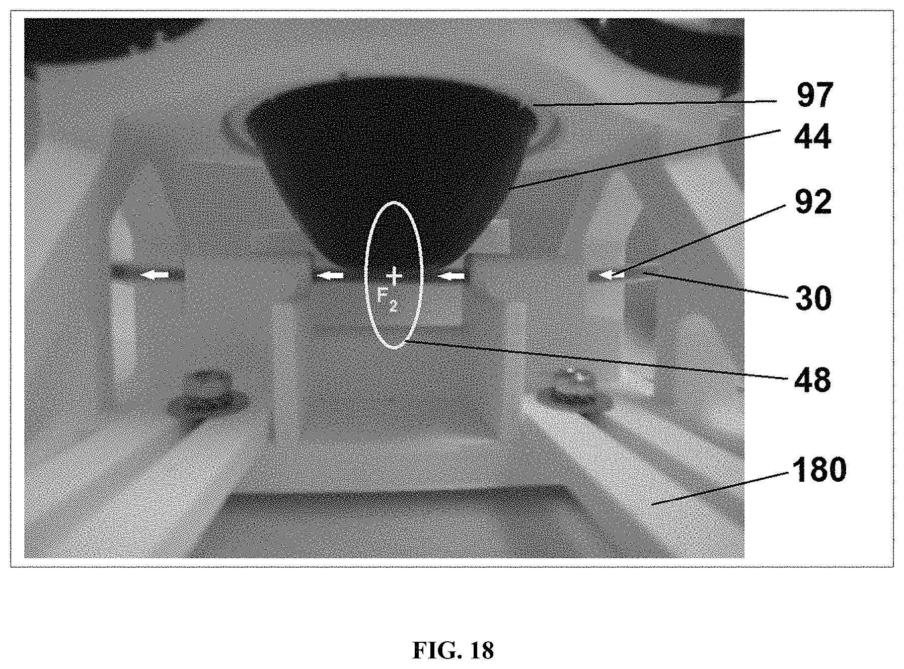 Patent US11771781 Figure 18 – Reprocessing of contaminated reusable devices with direct contact of pressure waves
