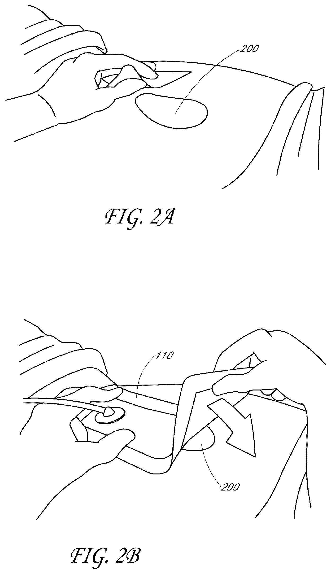 Patent US11771796 Figure 2 – Wound dressing and method of treatment