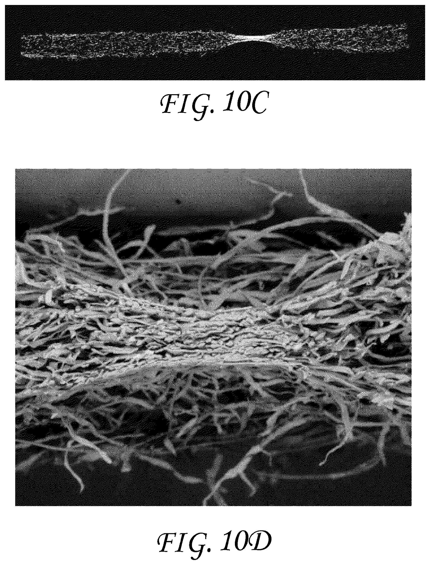 Patent US11771796 Figure 18 – Wound dressing and method of treatment