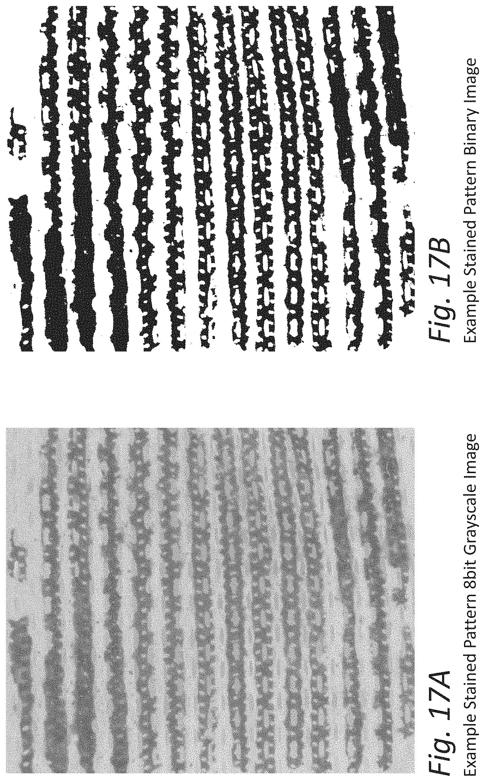 Patent US11771797 Figure 15 – Absorbent article with topsheet treated to reduce surfactant migration