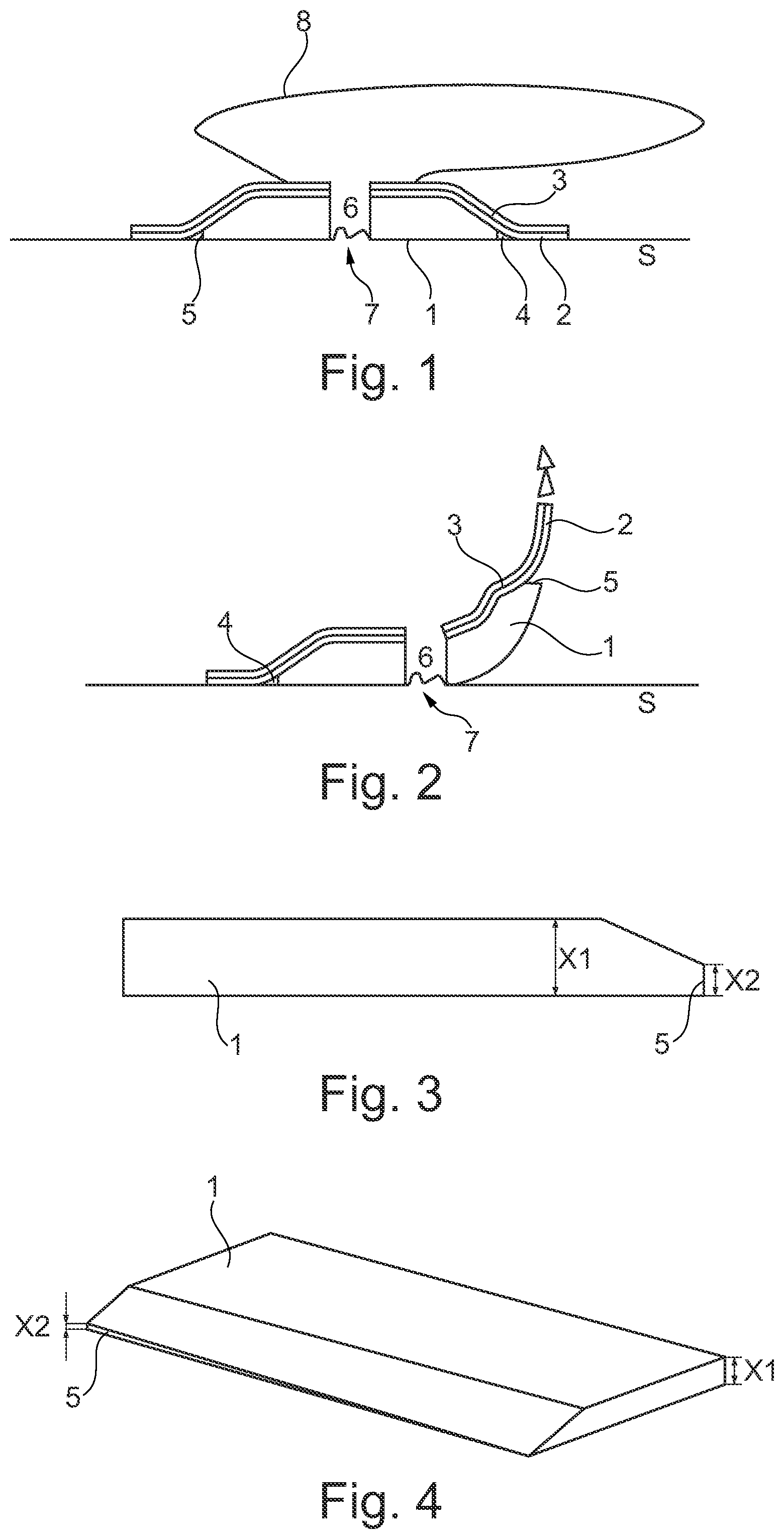 Patent US11771798 Figure 1 – Ostomy device with a switchable adhesive layer located between a backing layer and an absorbent adhesive layer