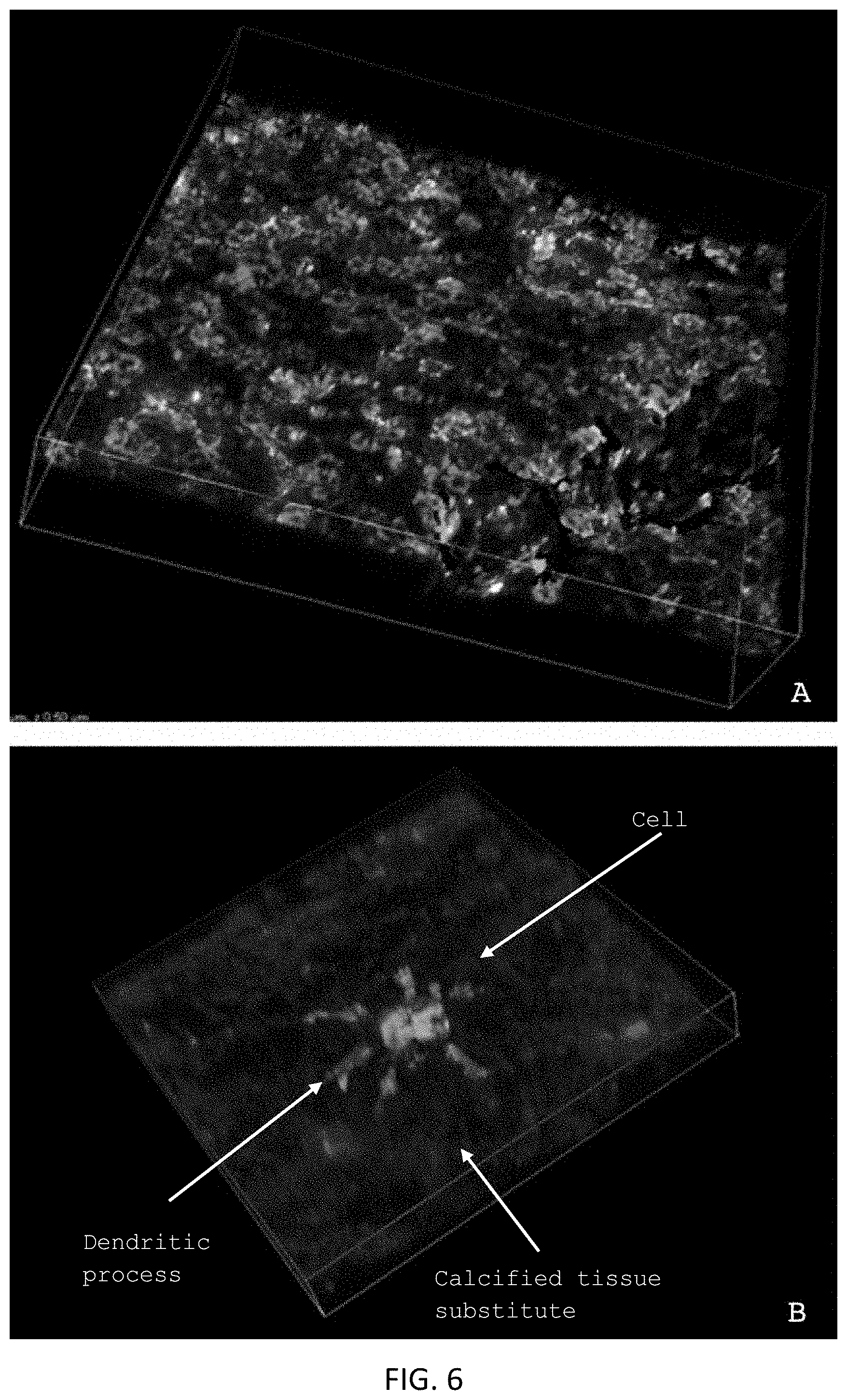 Patent US11771800 Figure 5 – Method for manufacturing a calcified tissue substitute
