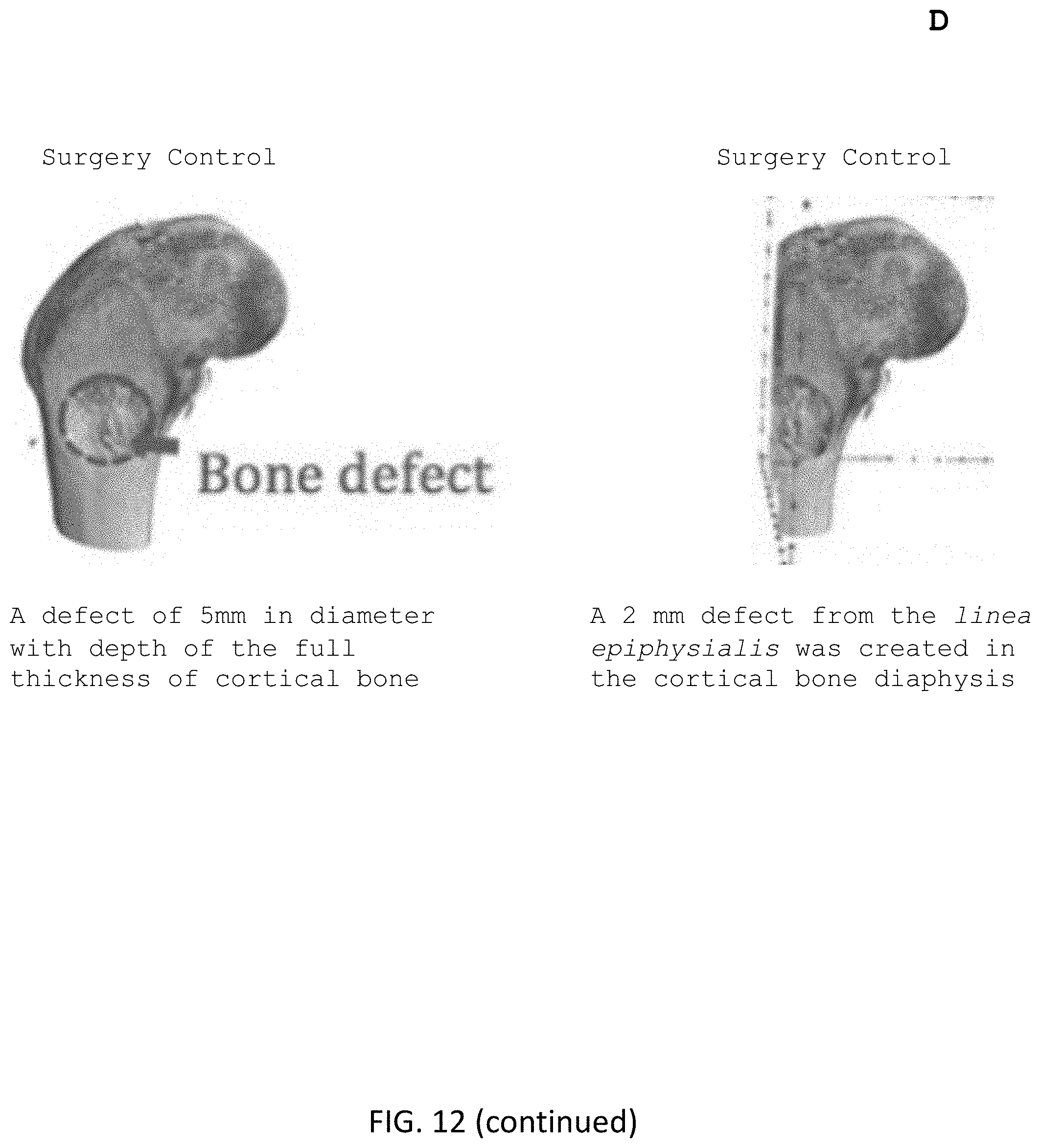 Patent US11771800 Figure 10 – Method for manufacturing a calcified tissue substitute
