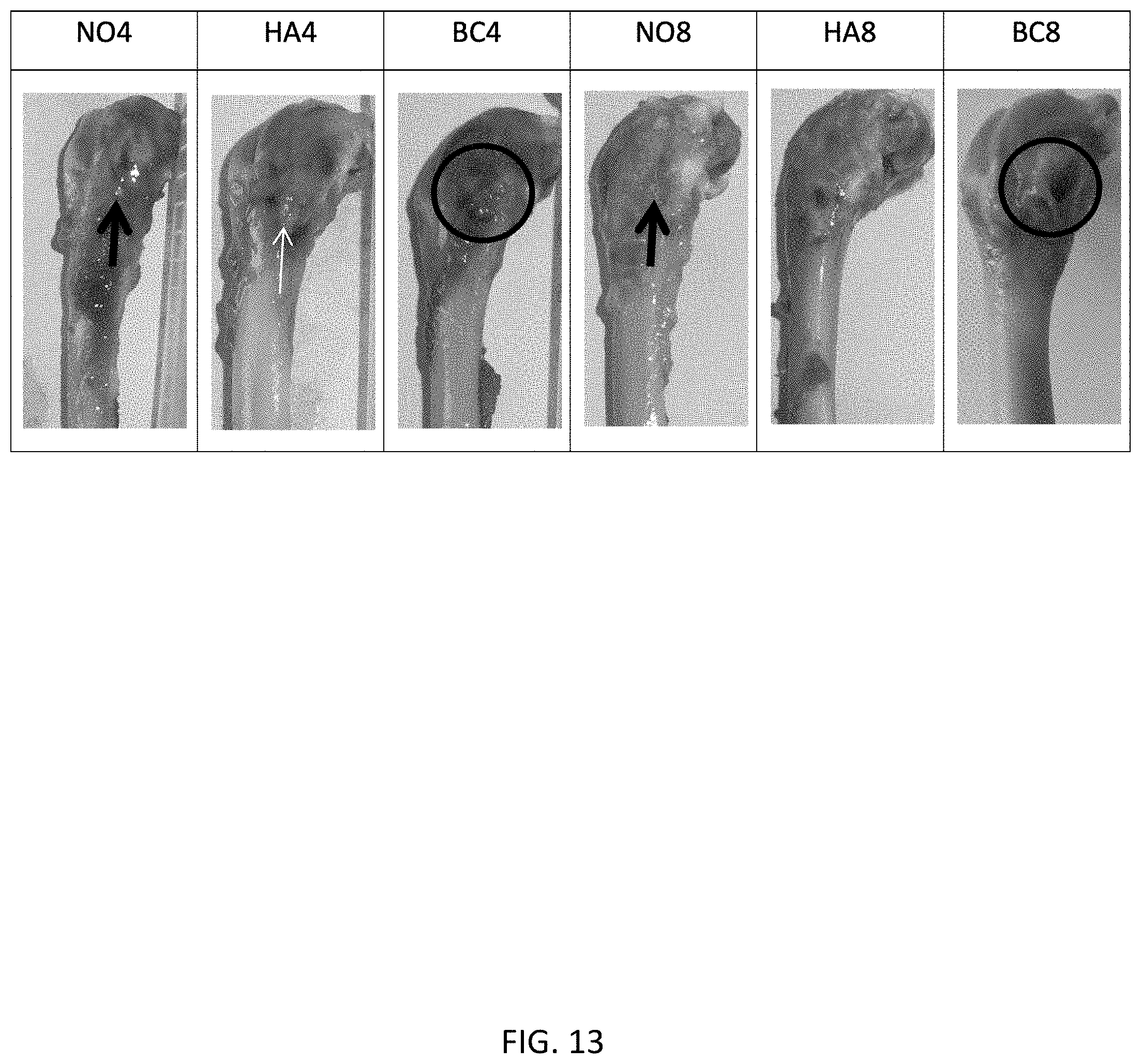 Patent US11771800 Figure 11 – Method for manufacturing a calcified tissue substitute