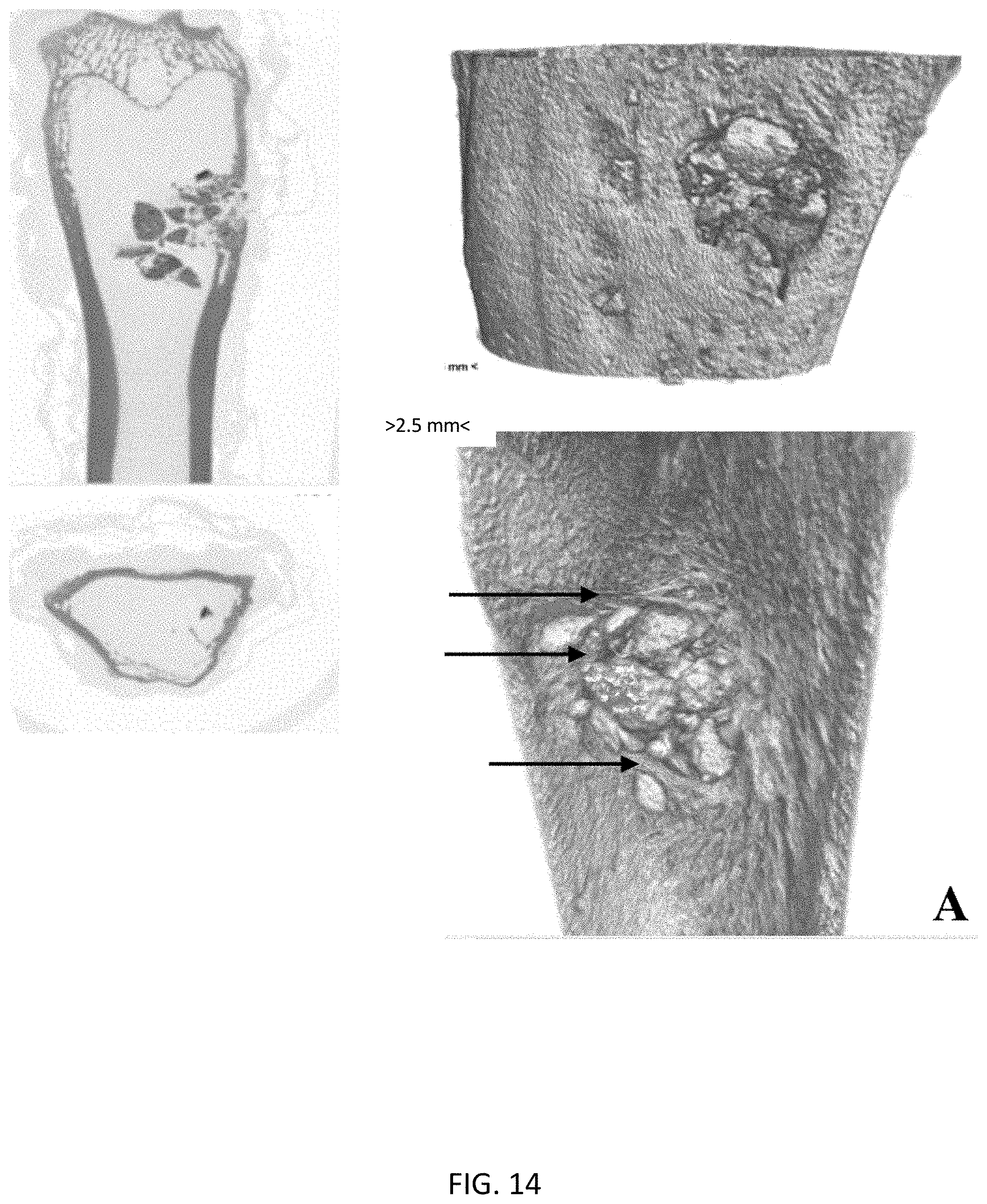 Patent US11771800 Figure 12 – Method for manufacturing a calcified tissue substitute