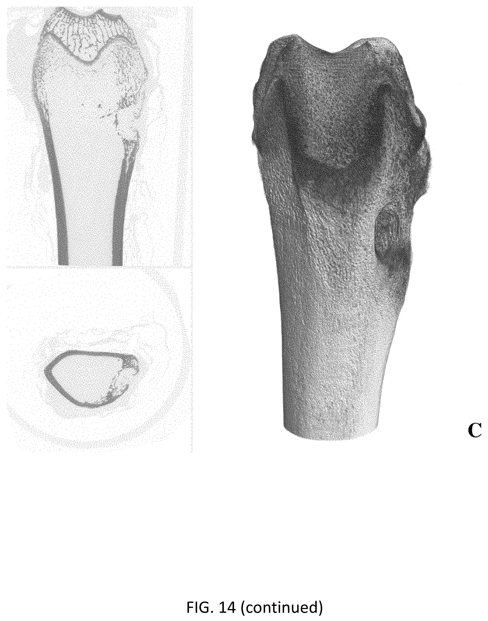 Patent US11771800 Figure 14 – Method for manufacturing a calcified tissue substitute