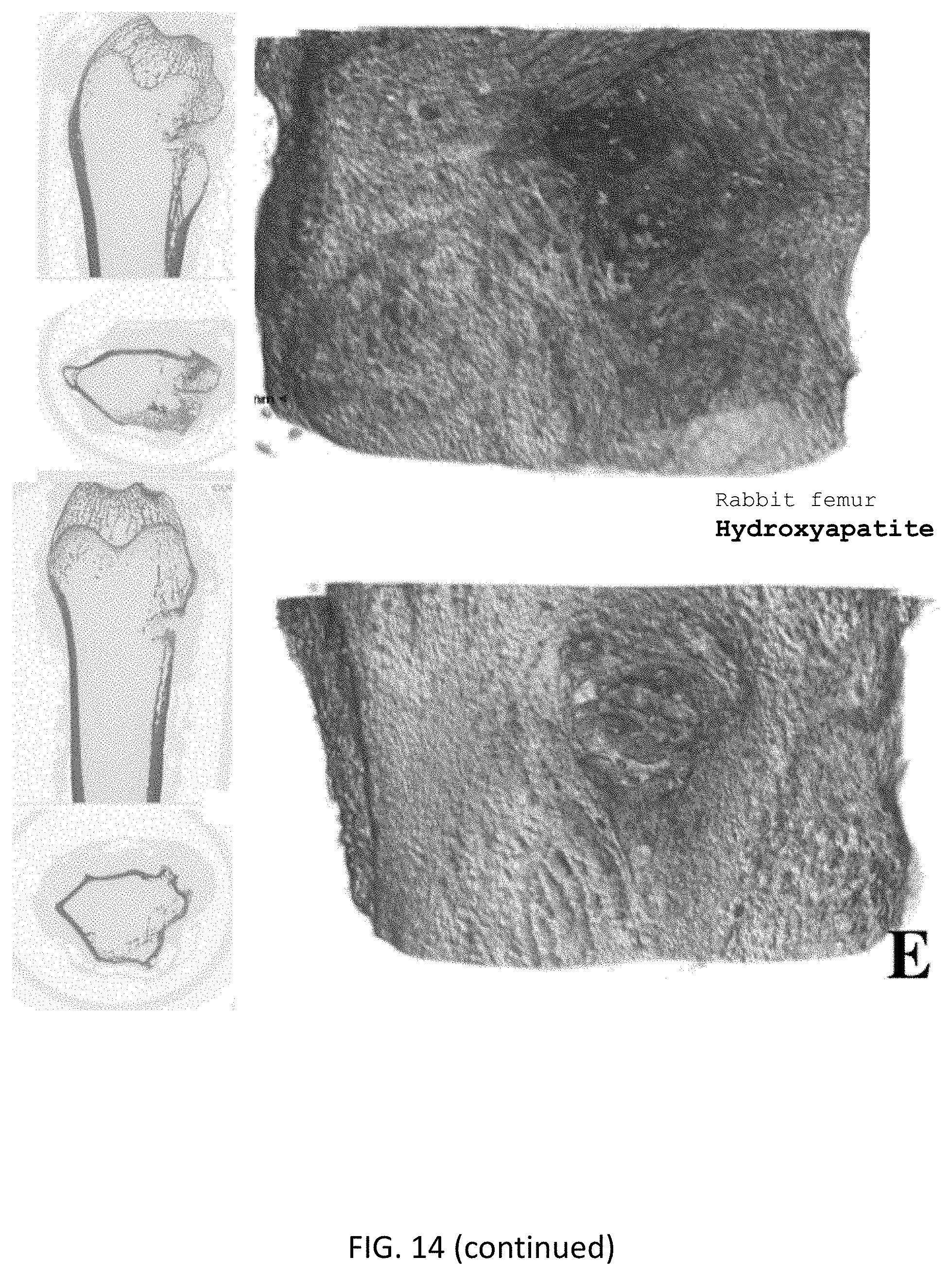 Patent US11771800 Figure 16 – Method for manufacturing a calcified tissue substitute