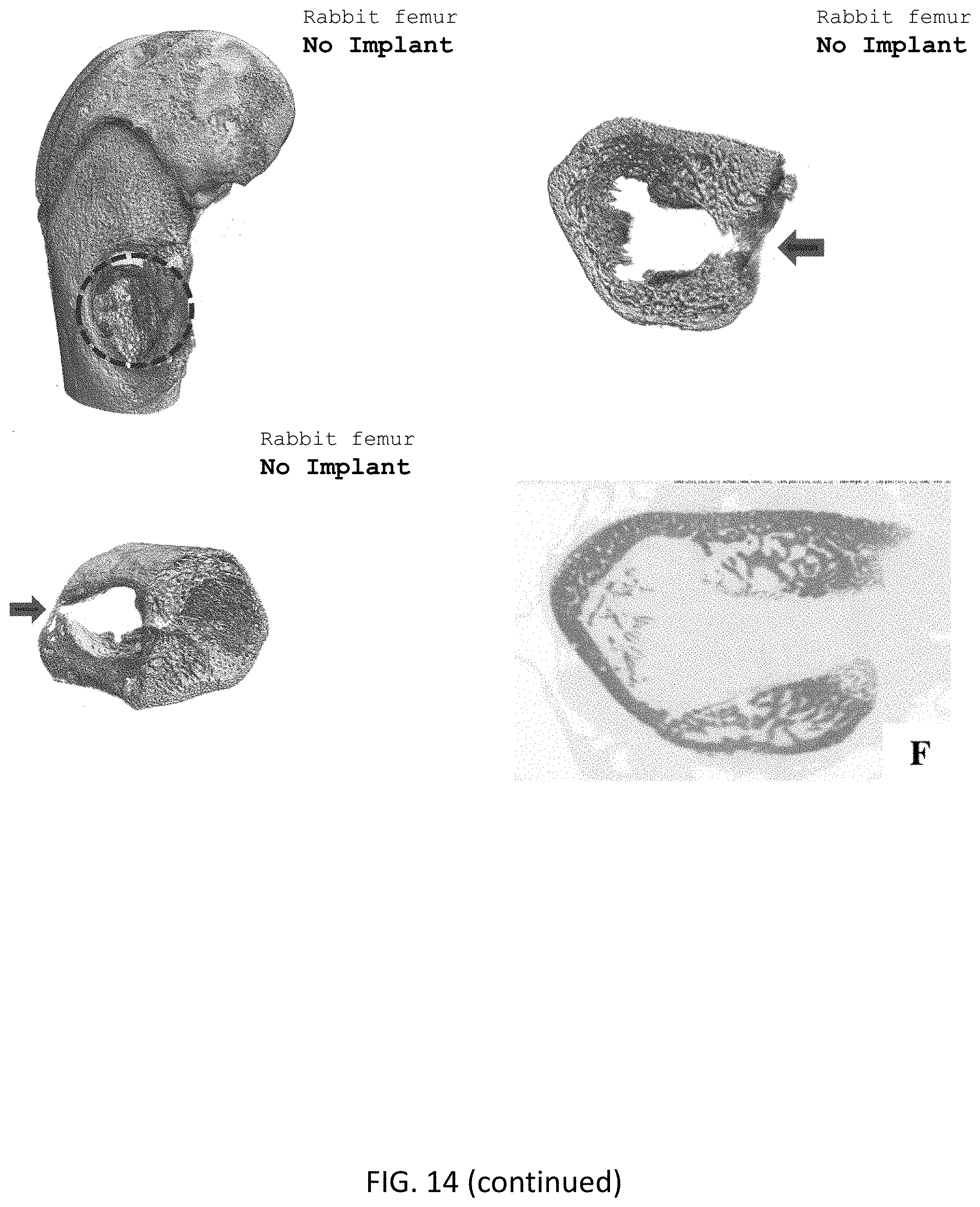 Patent US11771800 Figure 17 – Method for manufacturing a calcified tissue substitute