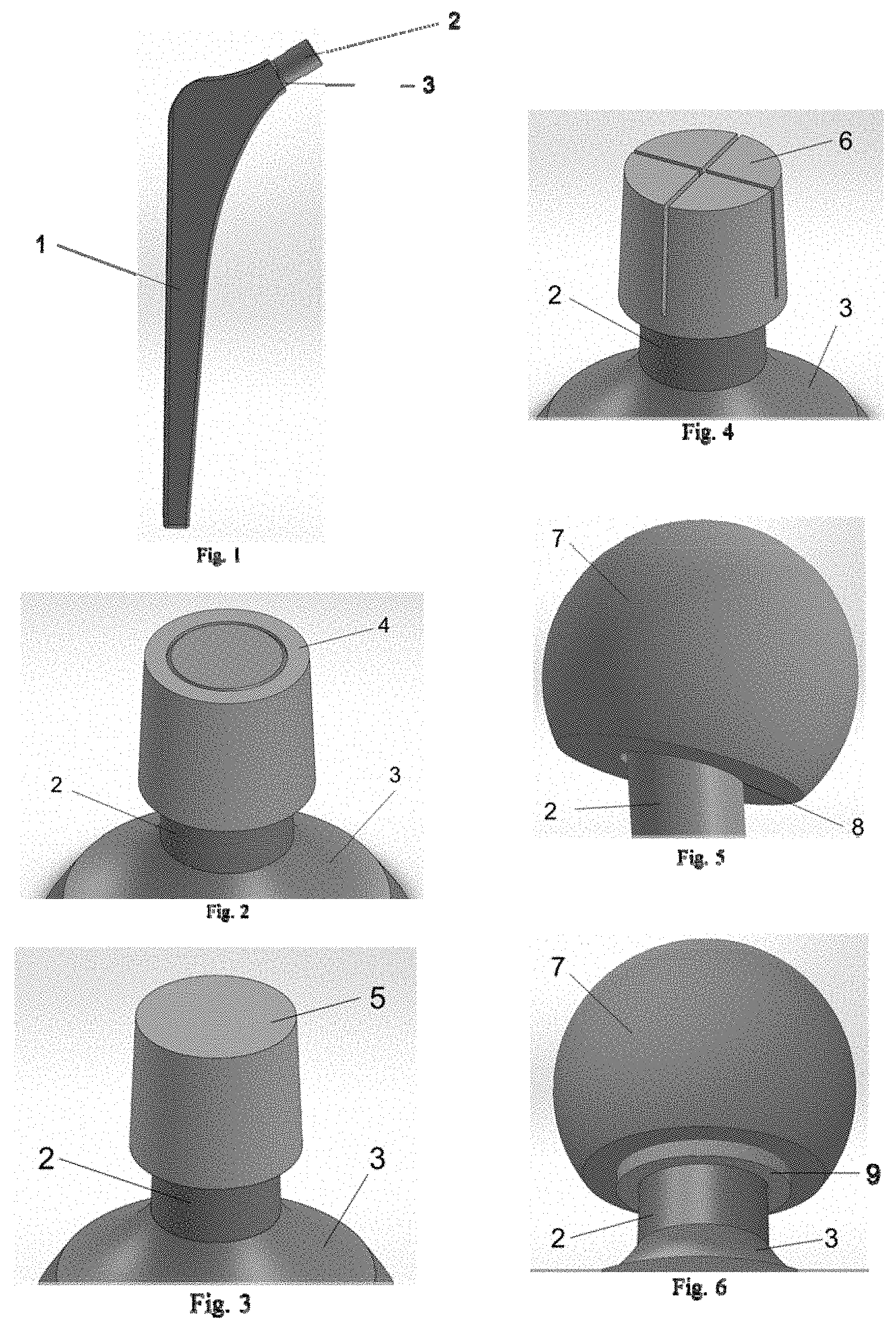 Patent US11771801 Figure 1 – Polymer sleeve for inhibiting stem wear and improving taper-lock in modular and non-modular orthopedic implants and the fabrication and processing thereof