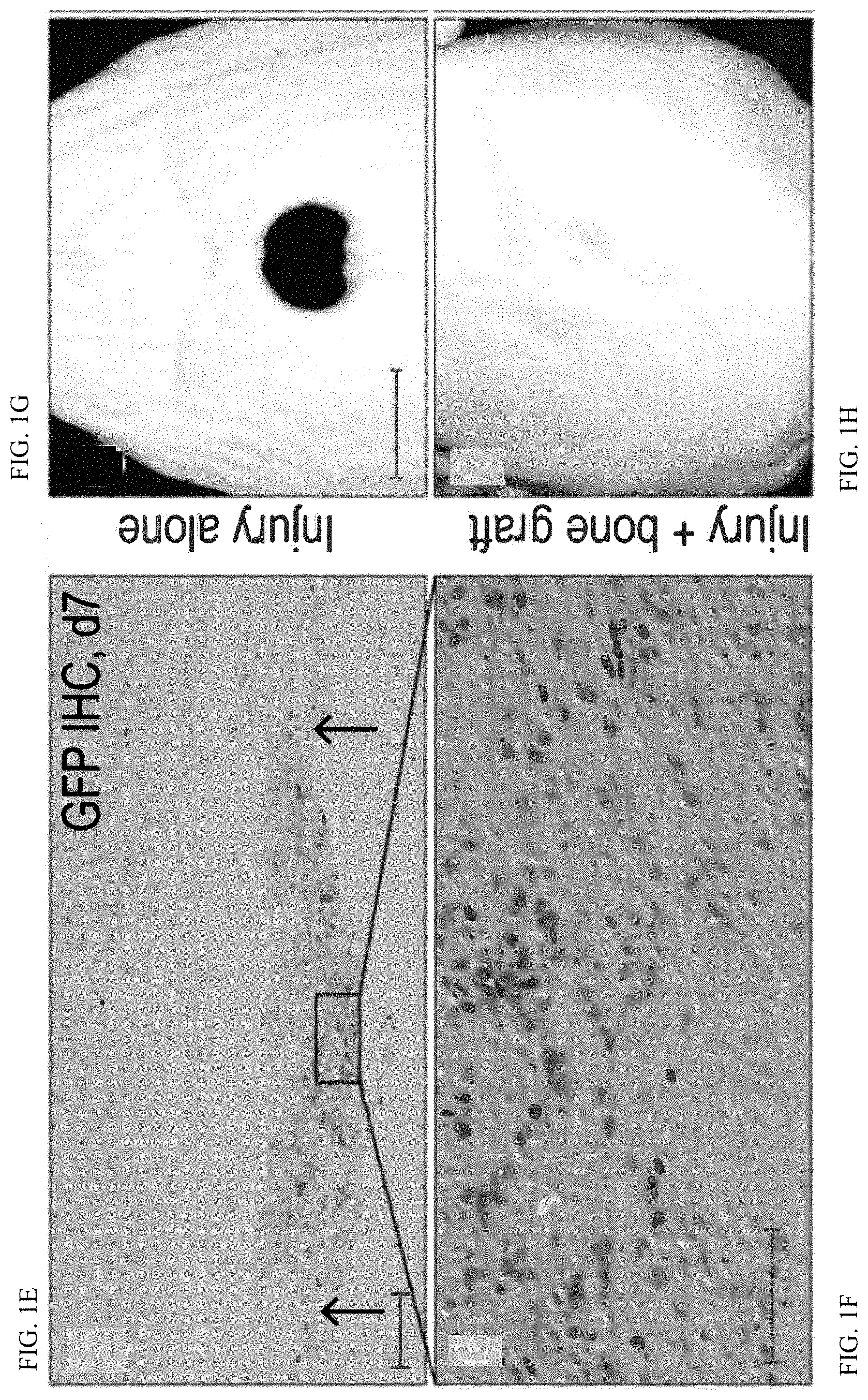 Patent US11771803 Figure 2 – Enhancement of osteogenic potential of bone grafts