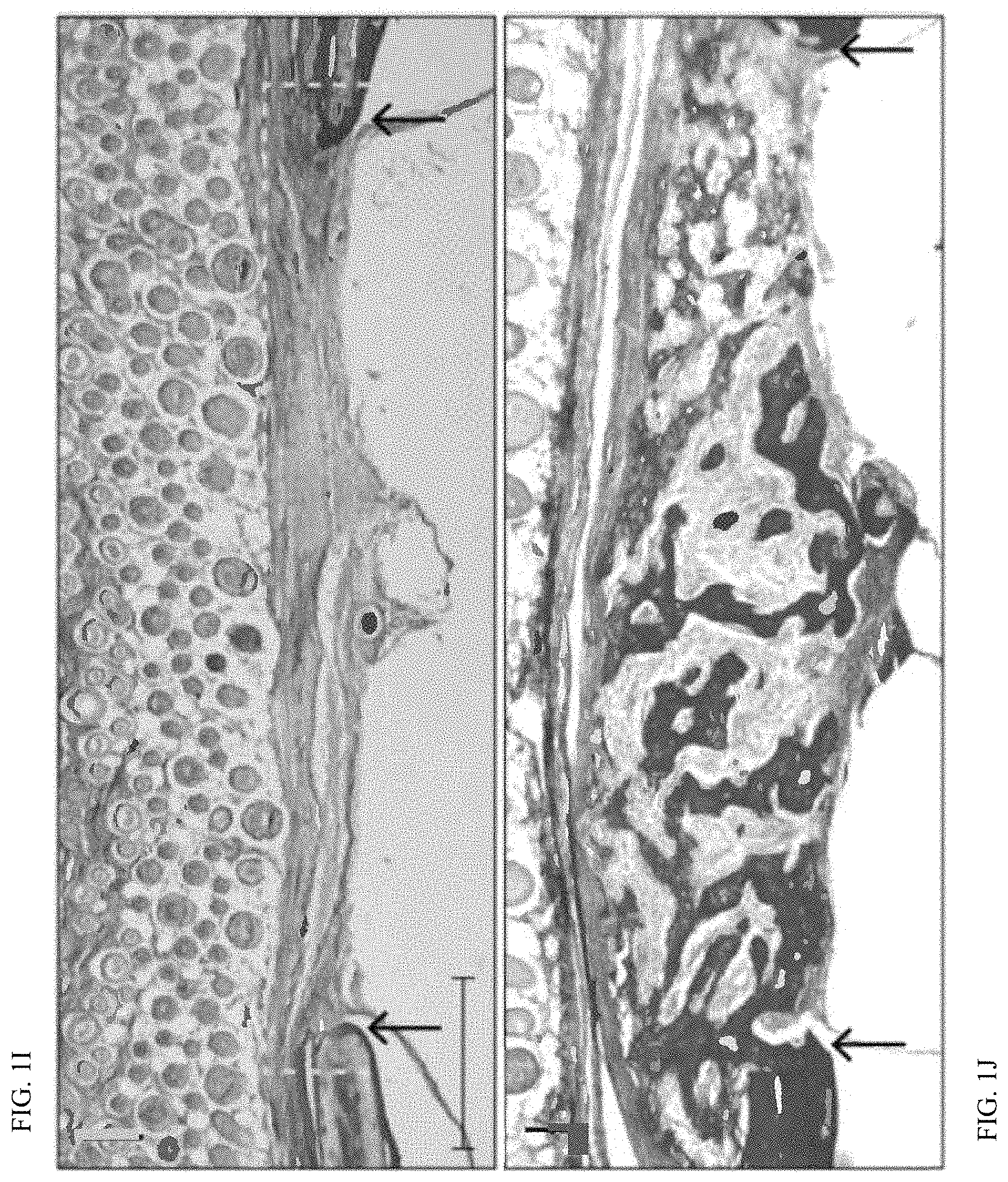 Patent US11771803 Figure 3 – Enhancement of osteogenic potential of bone grafts