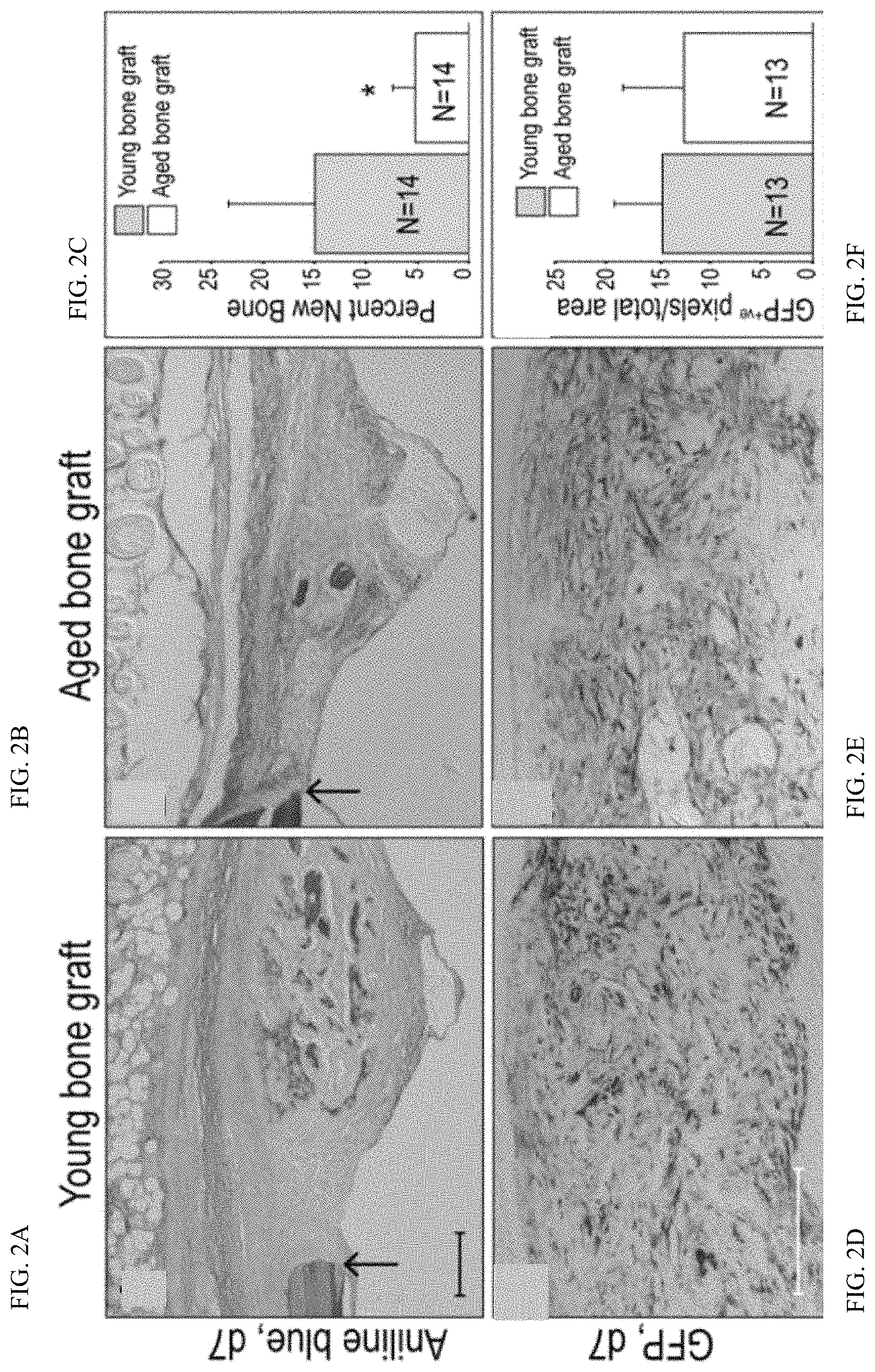 Patent US11771803 Figure 4 – Enhancement of osteogenic potential of bone grafts