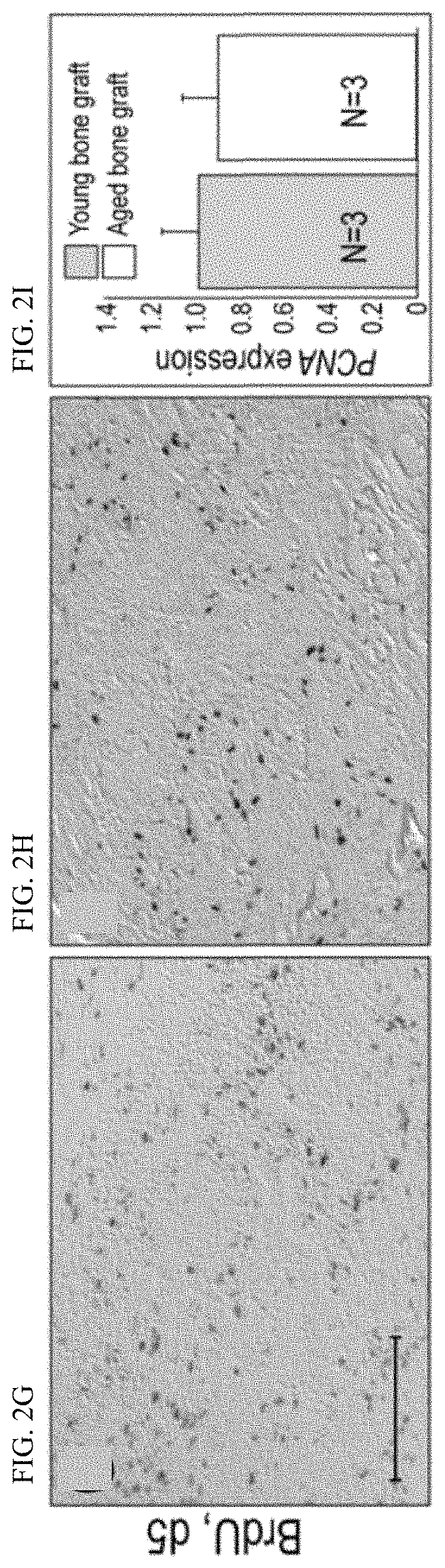 Patent US11771803 Figure 5 – Enhancement of osteogenic potential of bone grafts