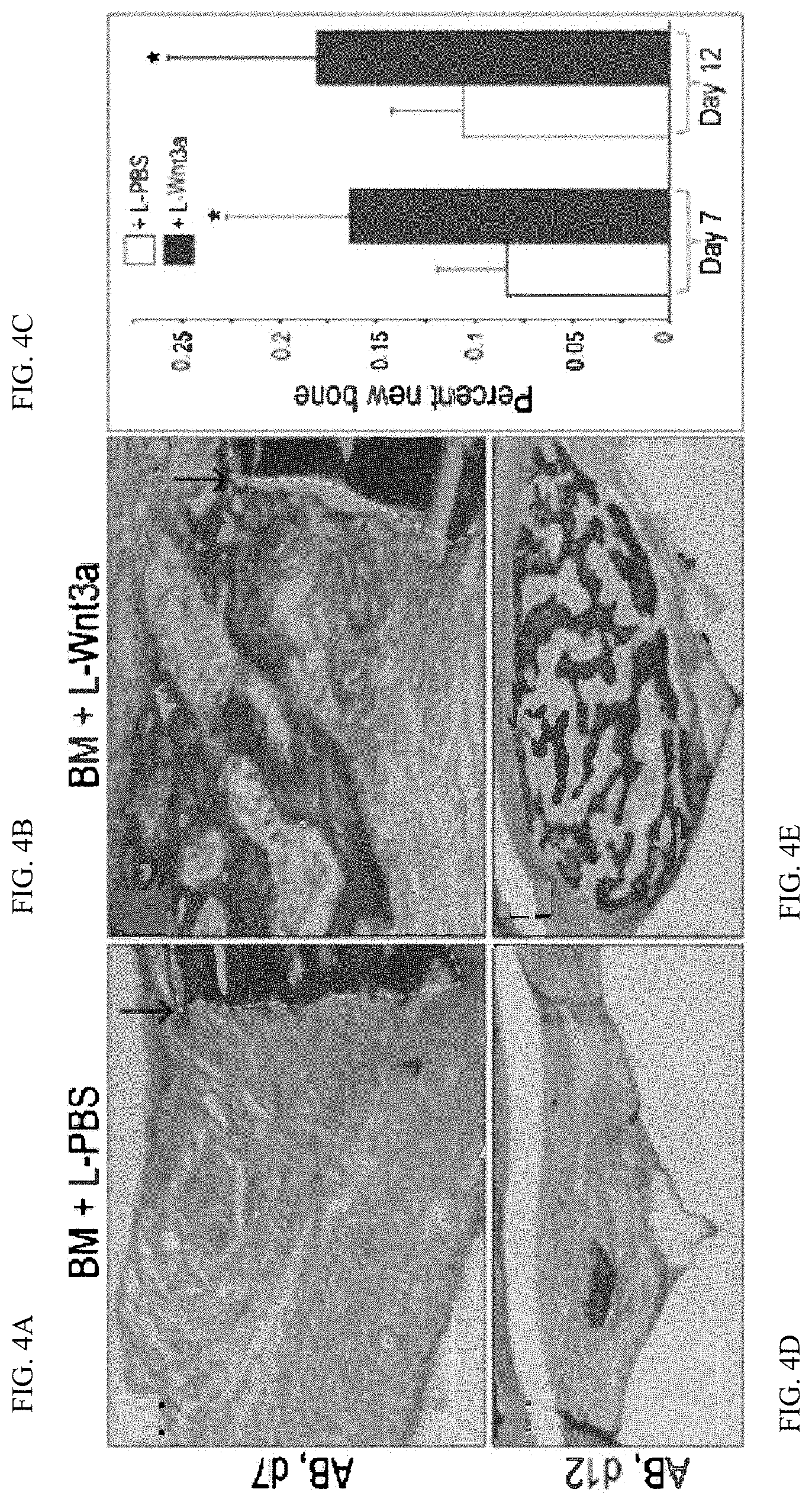 Patent US11771803 Figure 7 – Enhancement of osteogenic potential of bone grafts