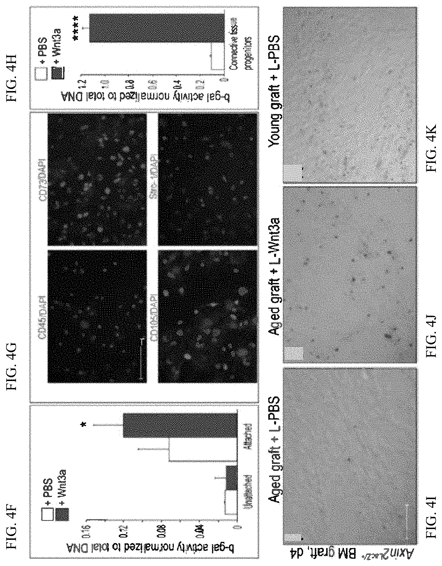 Patent US11771803 Figure 8 – Enhancement of osteogenic potential of bone grafts