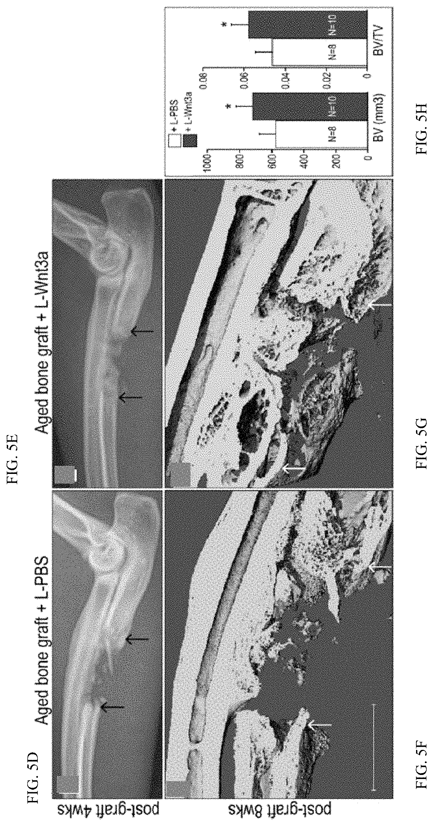 Patent US11771803 Figure 10 – Enhancement of osteogenic potential of bone grafts