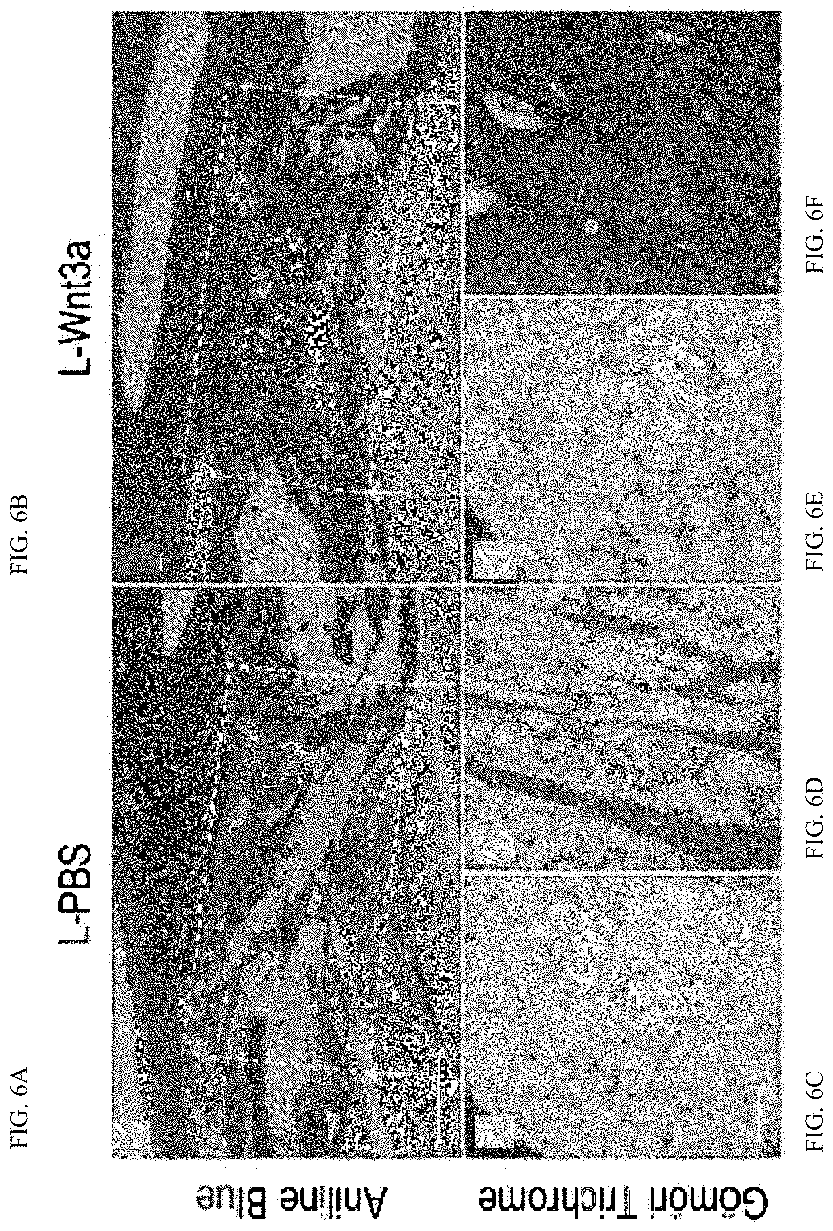 Patent US11771803 Figure 11 – Enhancement of osteogenic potential of bone grafts