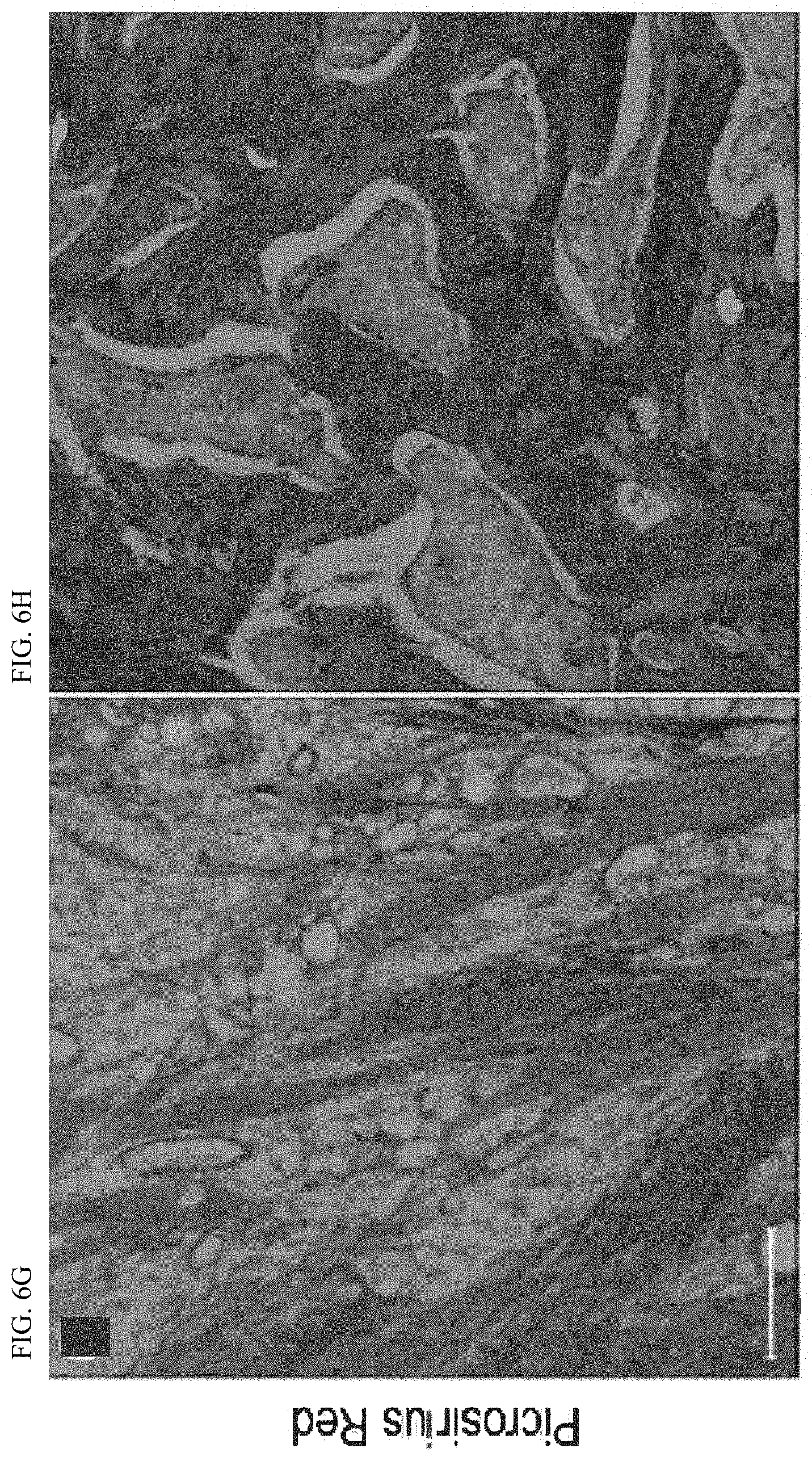 Patent US11771803 Figure 12 – Enhancement of osteogenic potential of bone grafts