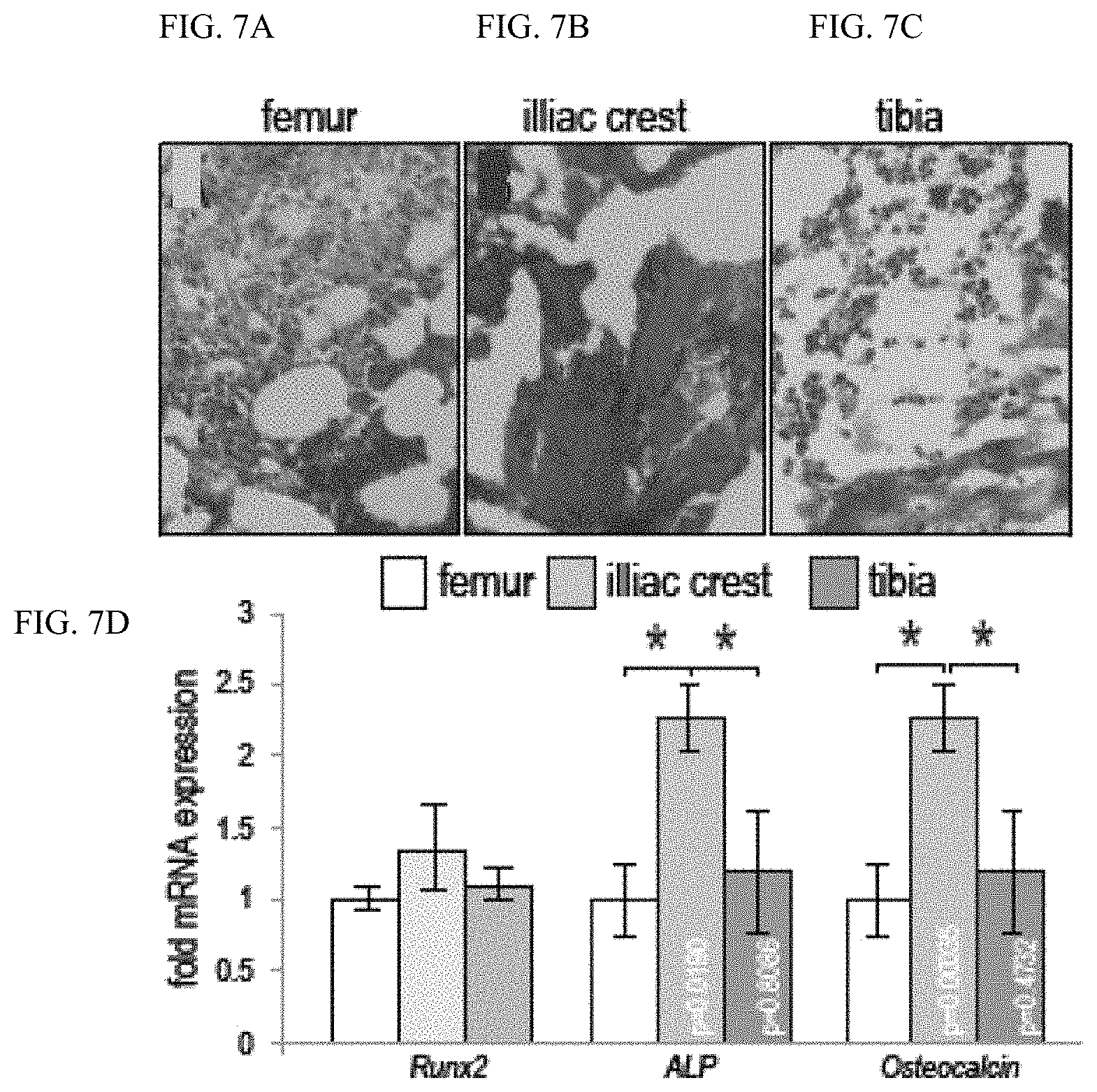 Patent US11771803 Figure 13 – Enhancement of osteogenic potential of bone grafts