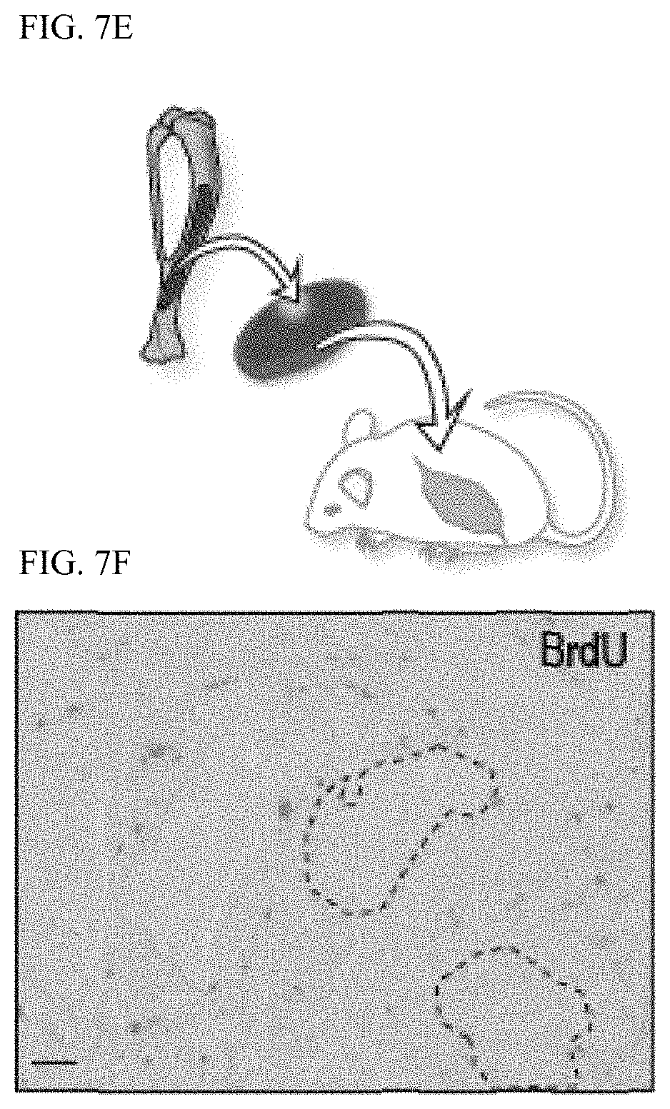 Patent US11771803 Figure 14 – Enhancement of osteogenic potential of bone grafts