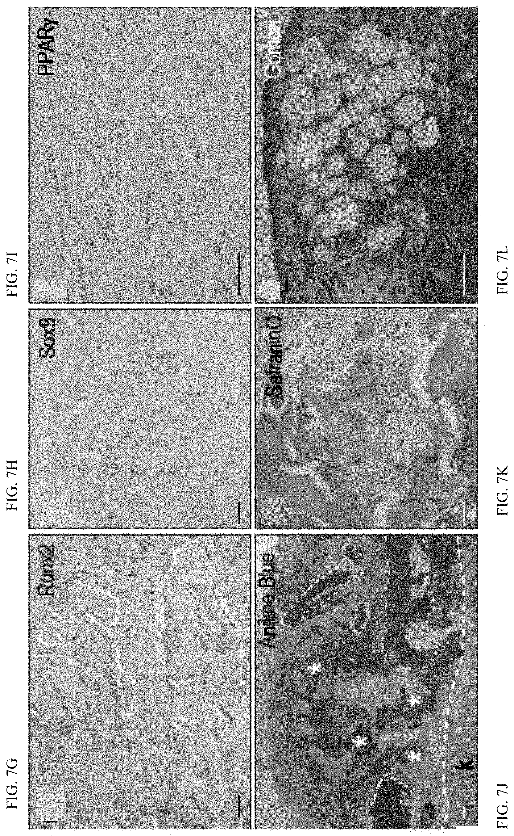 Patent US11771803 Figure 15 – Enhancement of osteogenic potential of bone grafts
