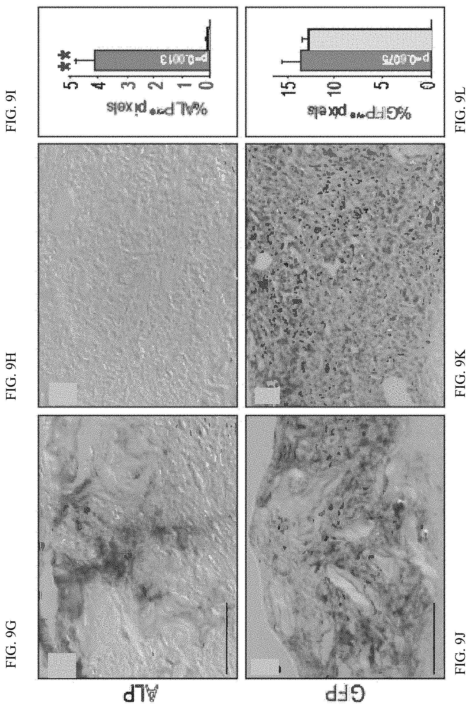 Patent US11771803 Figure 18 – Enhancement of osteogenic potential of bone grafts