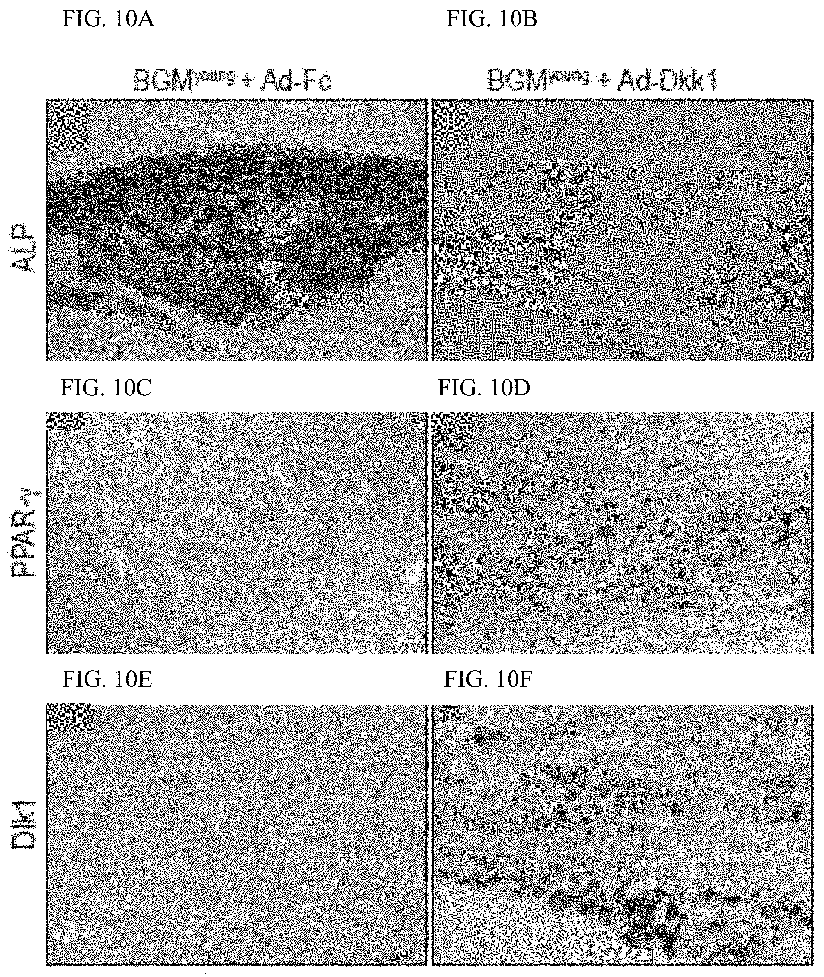 Patent US11771803 Figure 19 – Enhancement of osteogenic potential of bone grafts