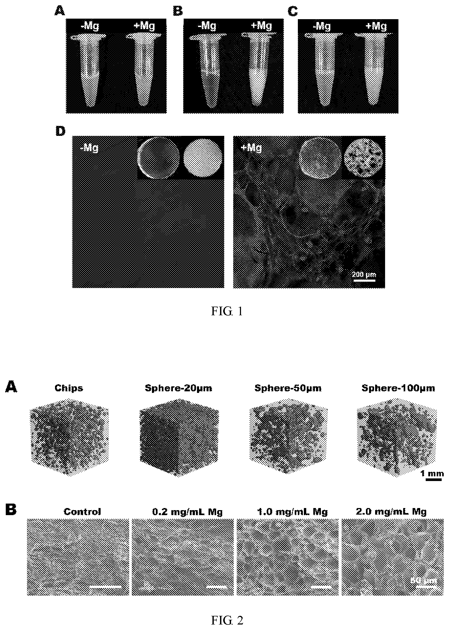 Patent US11771805 Figure 1 – Injectable in situ pore-forming hydrogel system and preparation method and use thereof