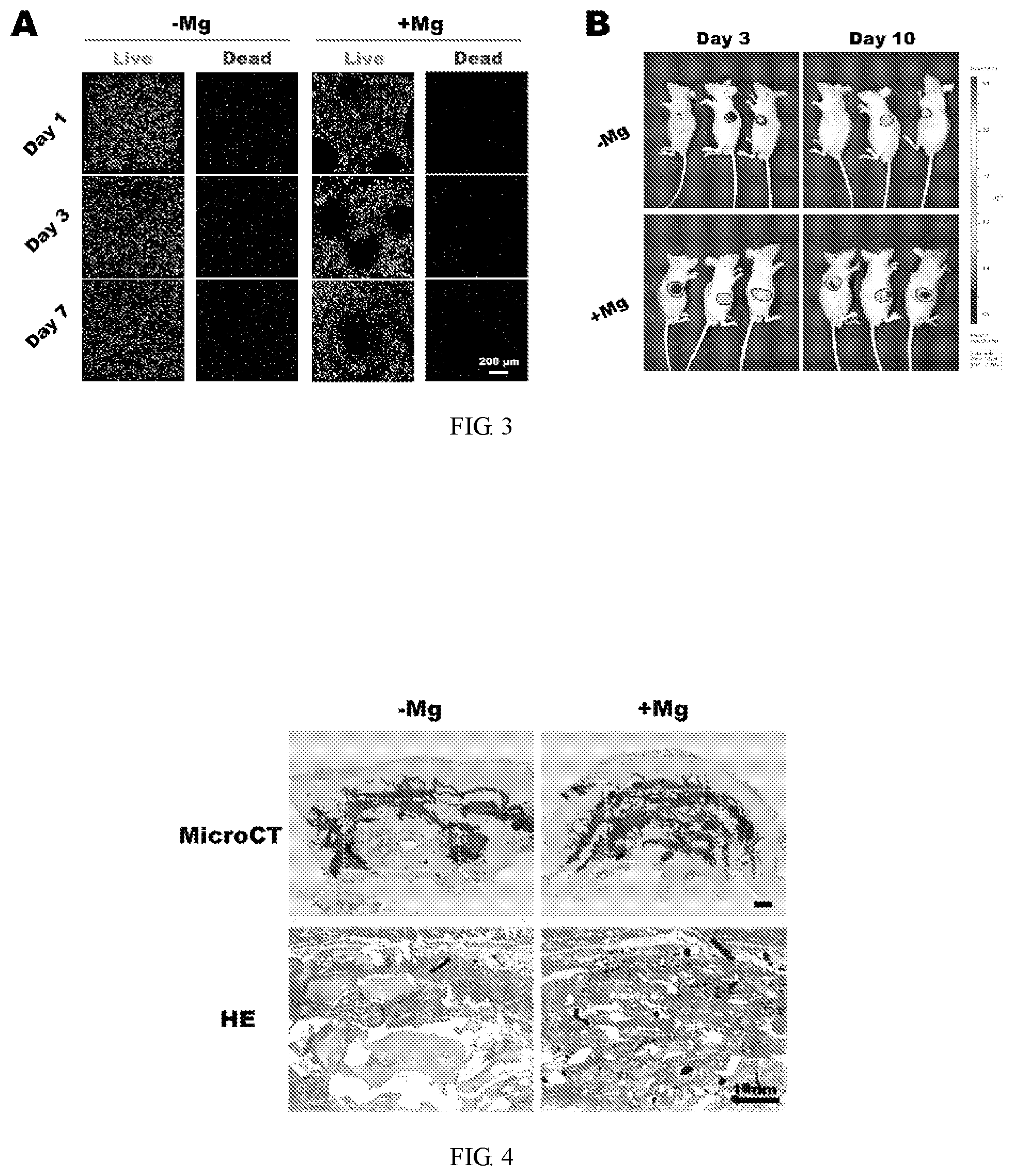 Patent US11771805 Figure 2 – Injectable in situ pore-forming hydrogel system and preparation method and use thereof