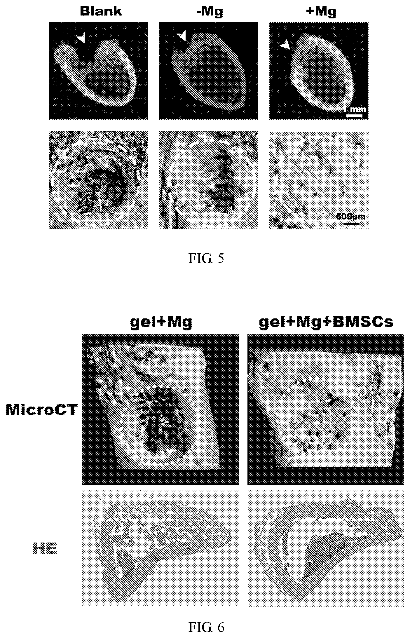 Patent US11771805 Figure 3 – Injectable in situ pore-forming hydrogel system and preparation method and use thereof