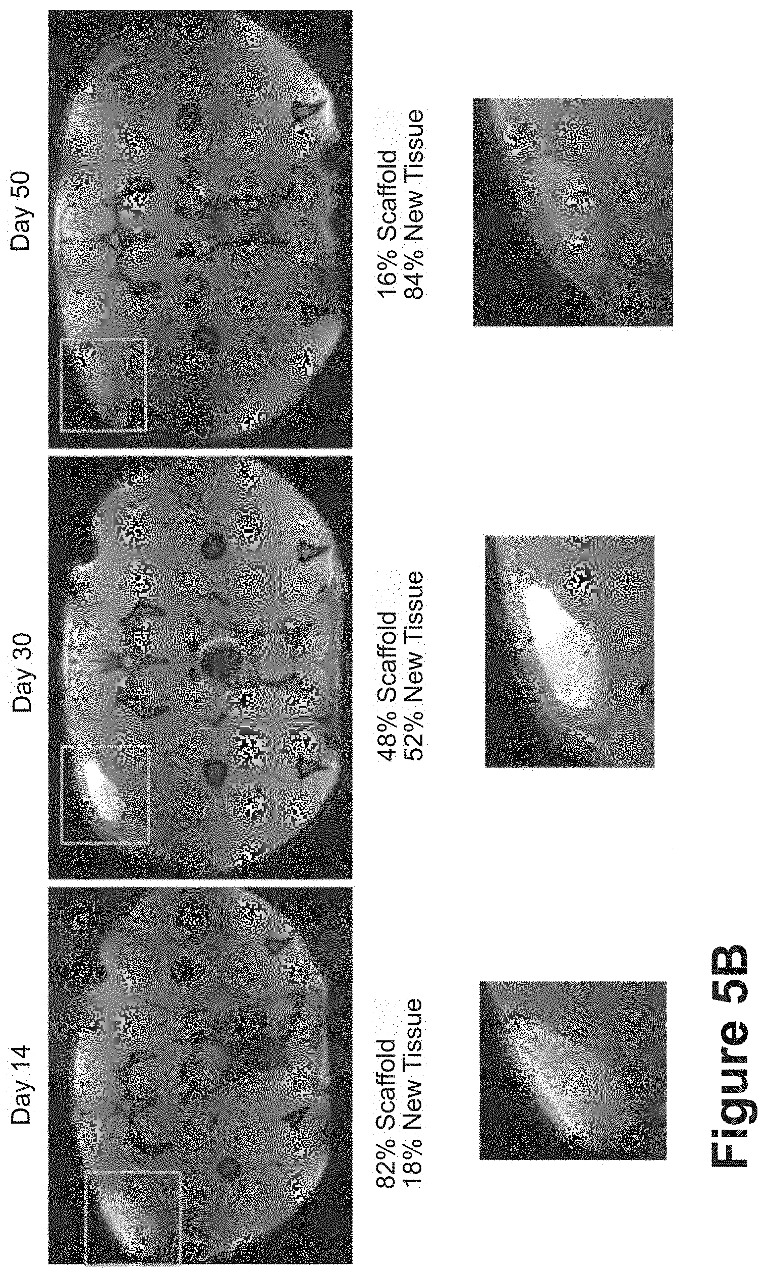 Patent US11771807 Figure 15 – Nanofiber-hydrogel composites for cell and tissue delivery