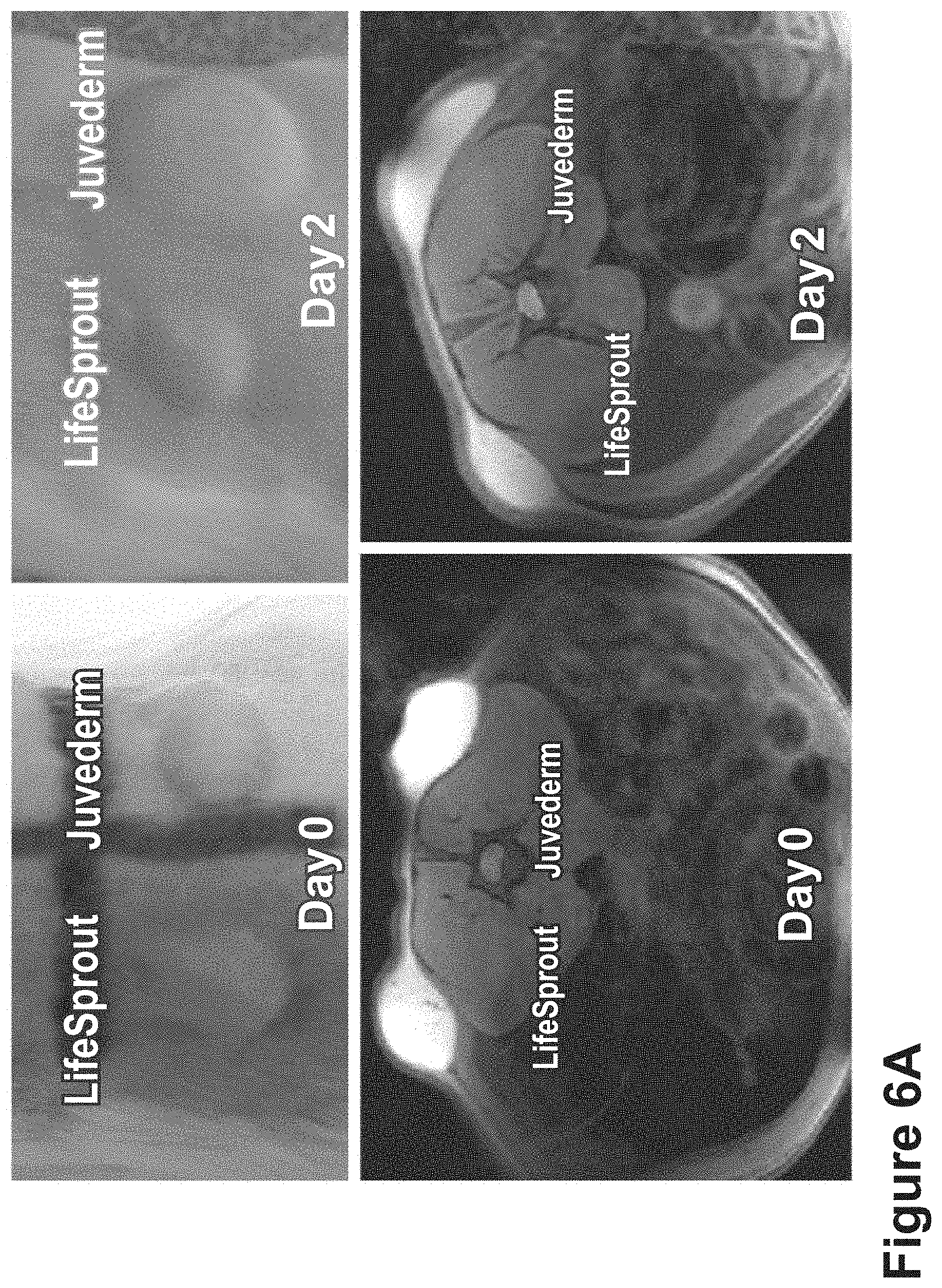 Patent US11771807 Figure 17 – Nanofiber-hydrogel composites for cell and tissue delivery