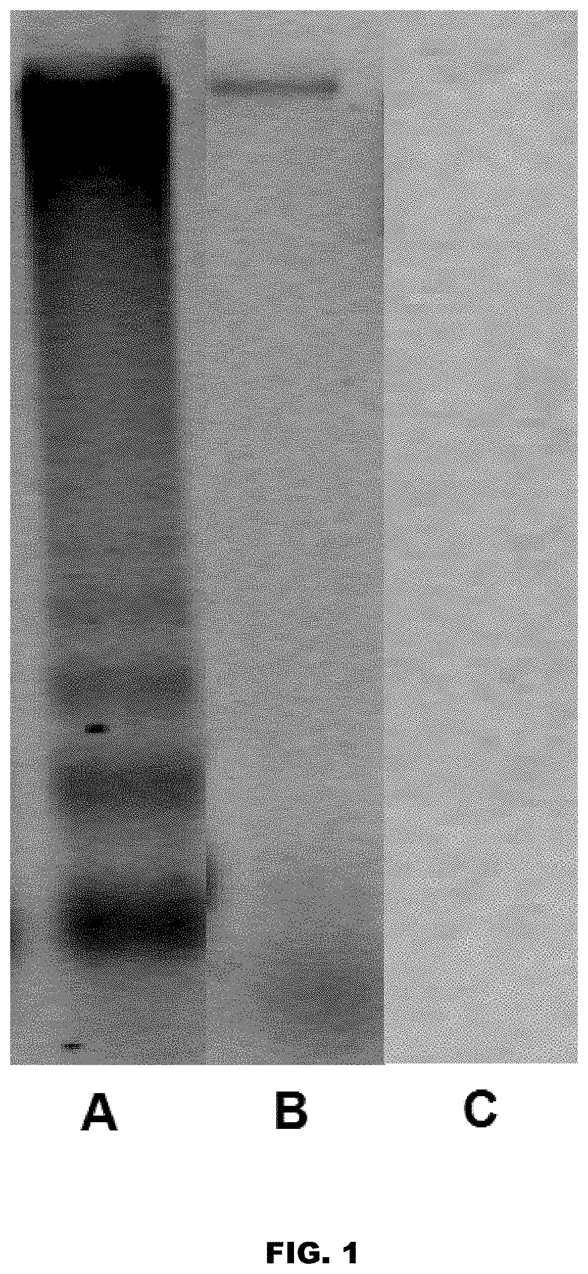 Patent US11771811 Figure 1 – Method and device for purification of blood from circulating cell free DNA