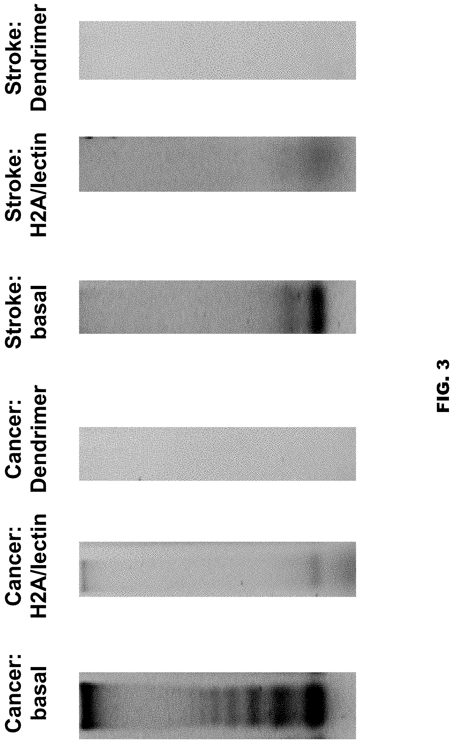 Patent US11771811 Figure 3 – Method and device for purification of blood from circulating cell free DNA