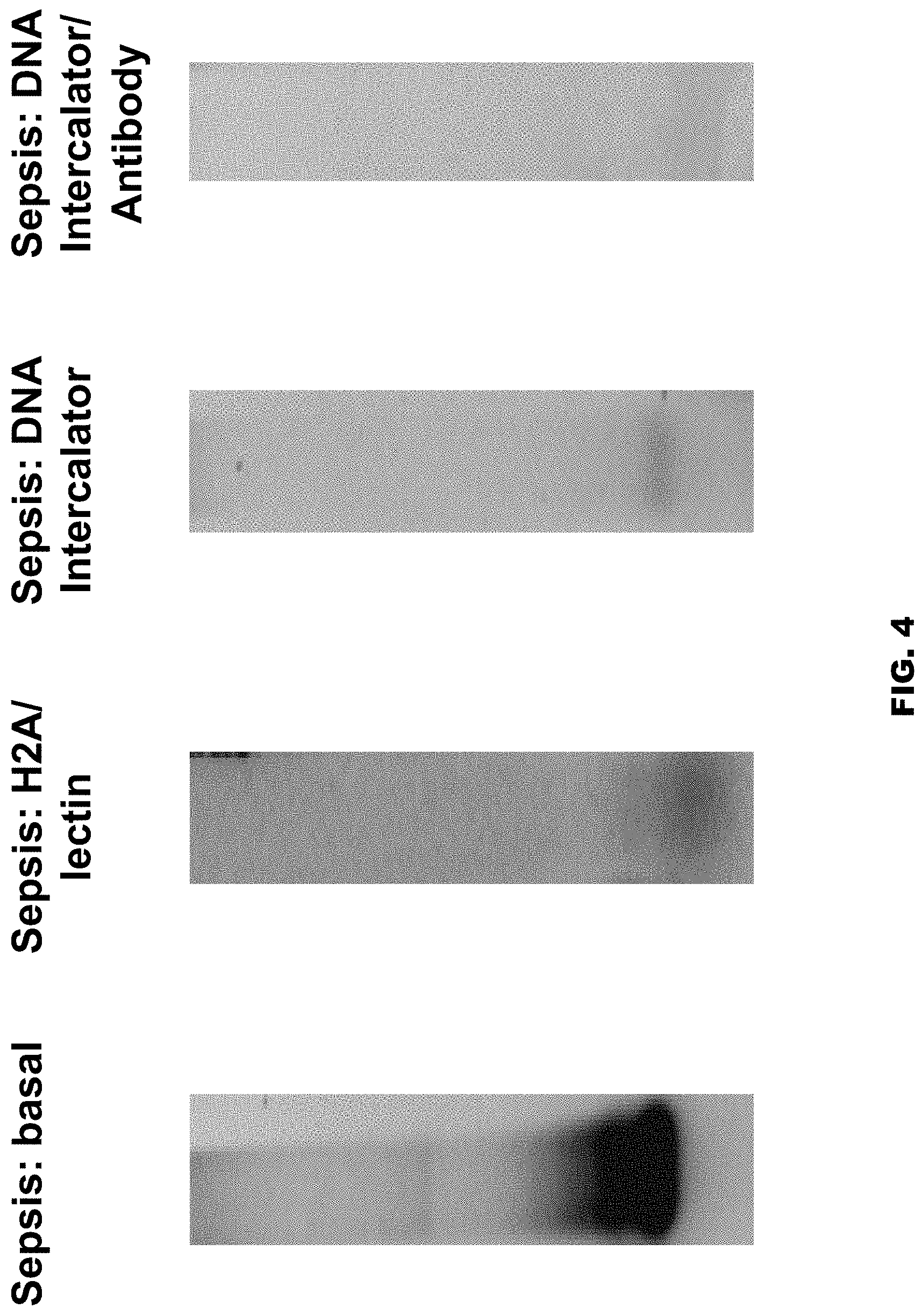 Patent US11771811 Figure 4 – Method and device for purification of blood from circulating cell free DNA