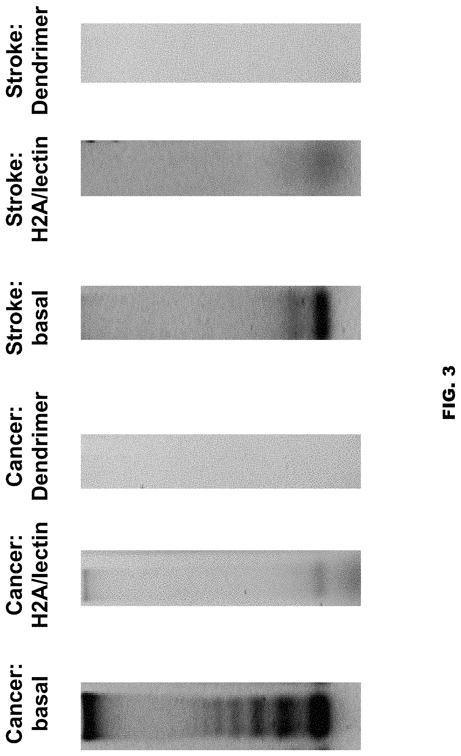 Patent US11771812 Figure 3 – Method and device for purification of blood from circulating cell free DNA