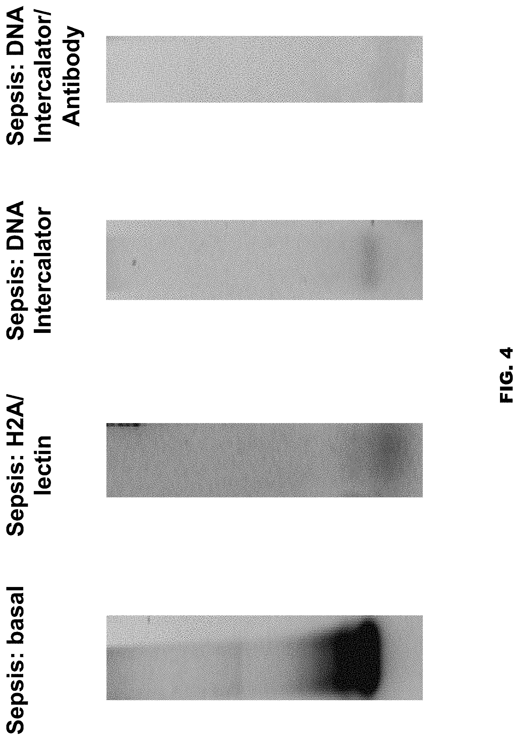 Patent US11771812 Figure 4 – Method and device for purification of blood from circulating cell free DNA