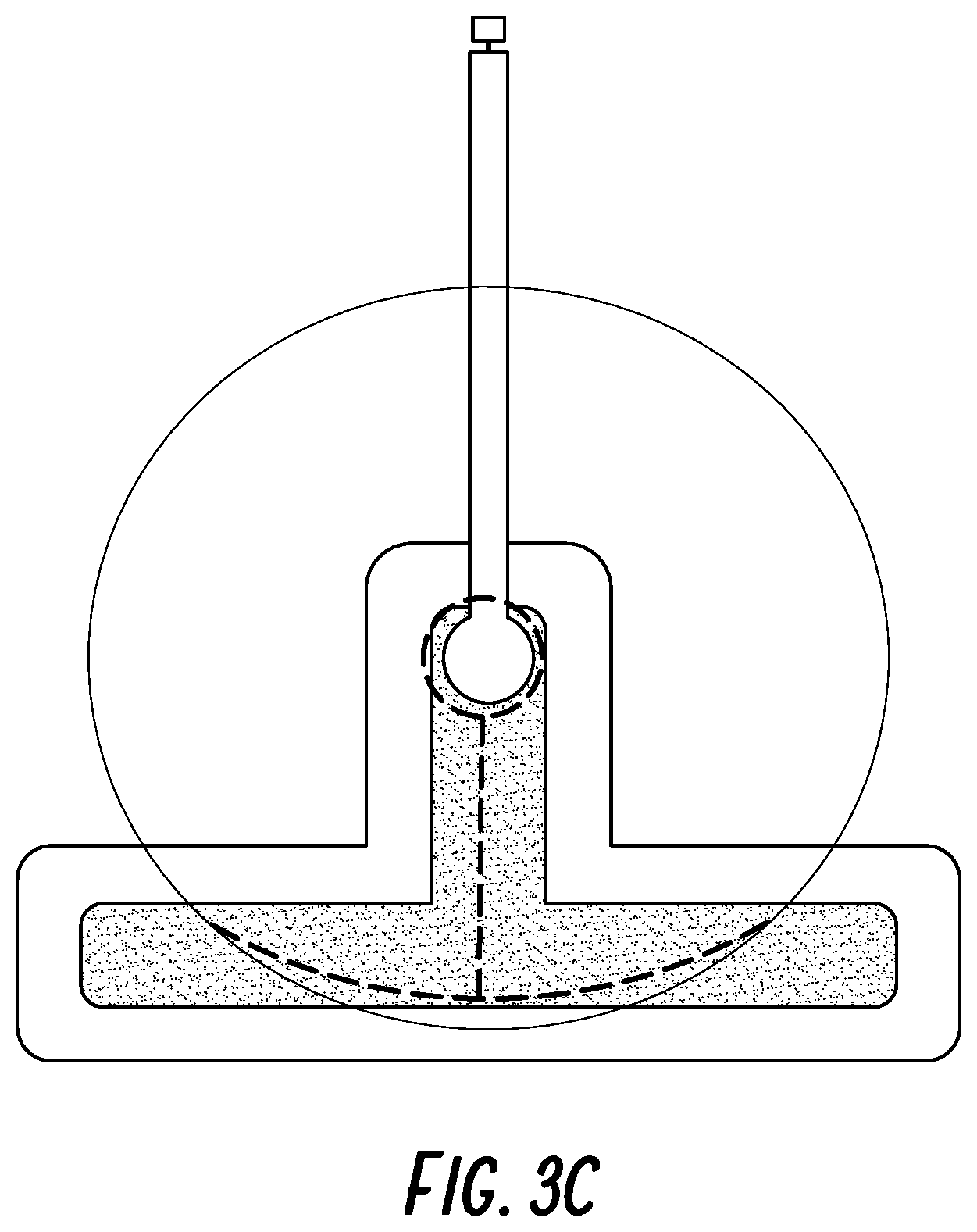 Patent US11771820 Figure 6 – Negative pressure wound therapy apparatus for post breast surgery wounds