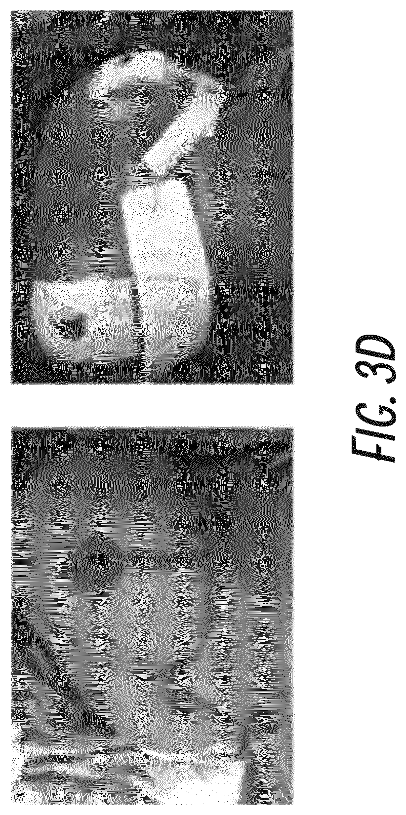 Patent US11771820 Figure 7 – Negative pressure wound therapy apparatus for post breast surgery wounds
