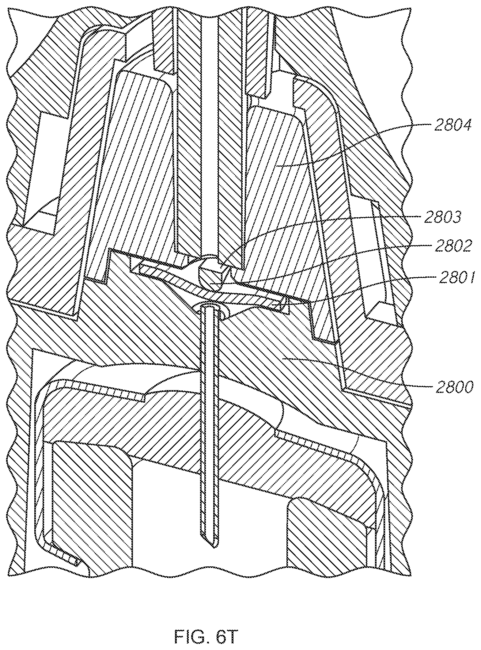 Patent US11771821 Figure 18 – Infusion system and components thereof