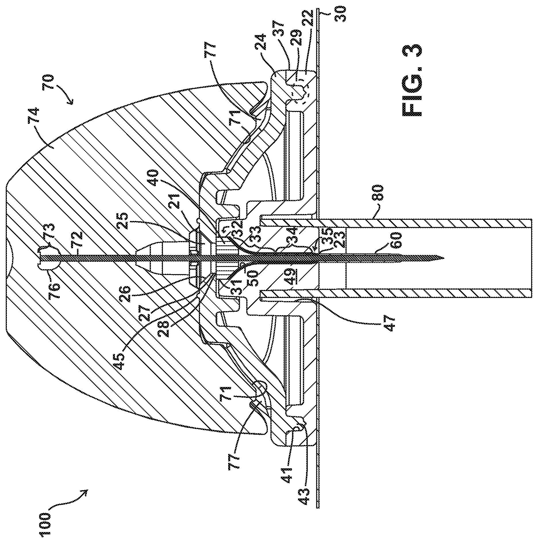 Patent US11771823 Figure 4 – Fluid delivery devices, systems and methods