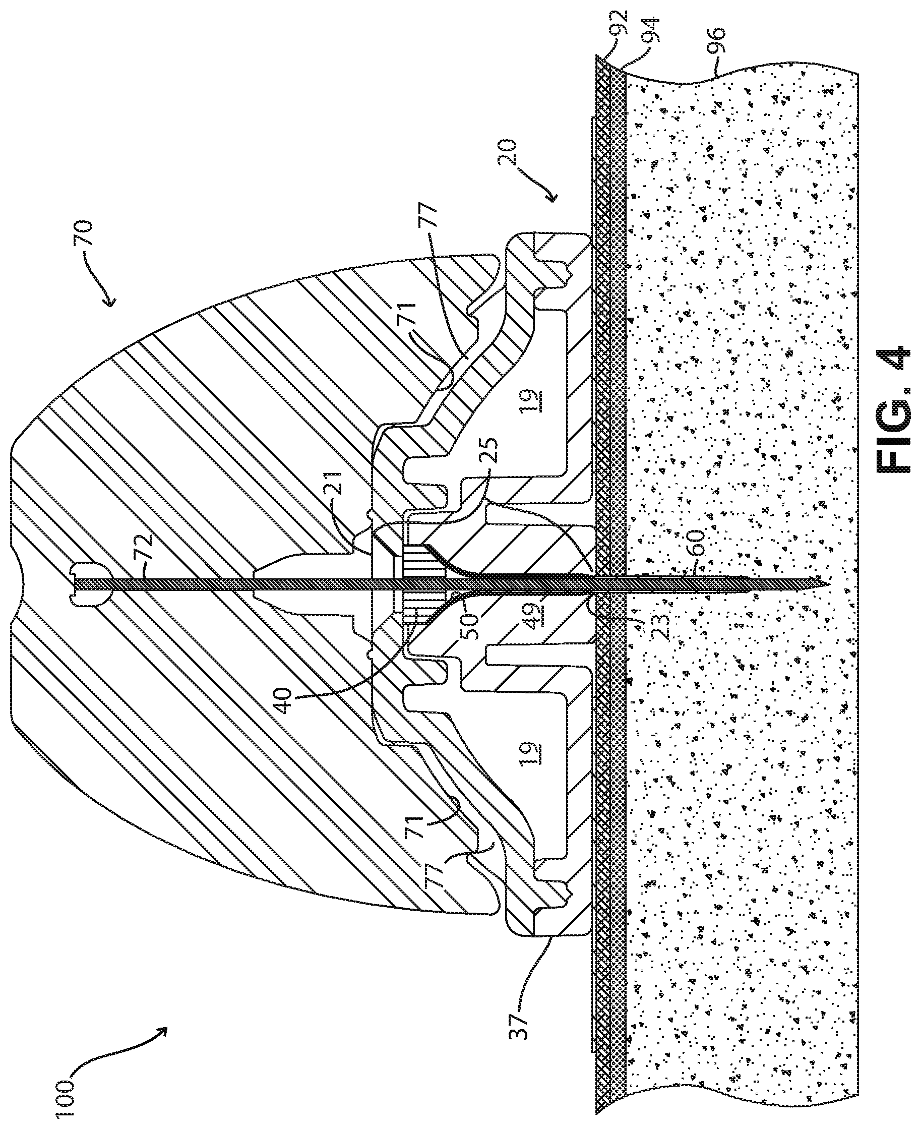 Patent US11771823 Figure 5 – Fluid delivery devices, systems and methods