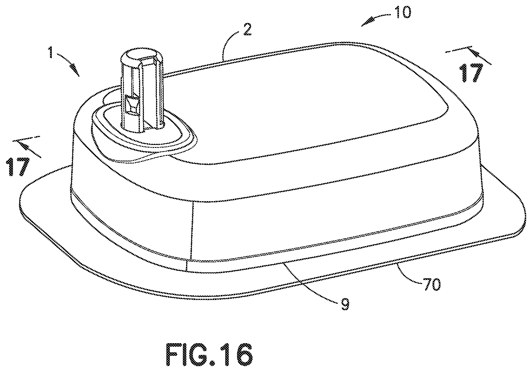 Patent US11771824 Figure 12 – Force sensing resistor for liquid low-volume detection and occlusion sensing and methods and apparatuses for flow sensing along fluid path in fluid delivery device
