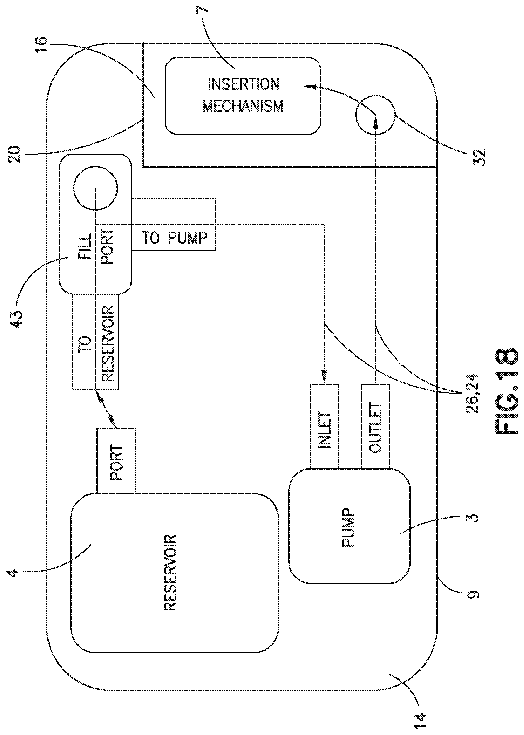 Patent US11771824 Figure 14 – Force sensing resistor for liquid low-volume detection and occlusion sensing and methods and apparatuses for flow sensing along fluid path in fluid delivery device